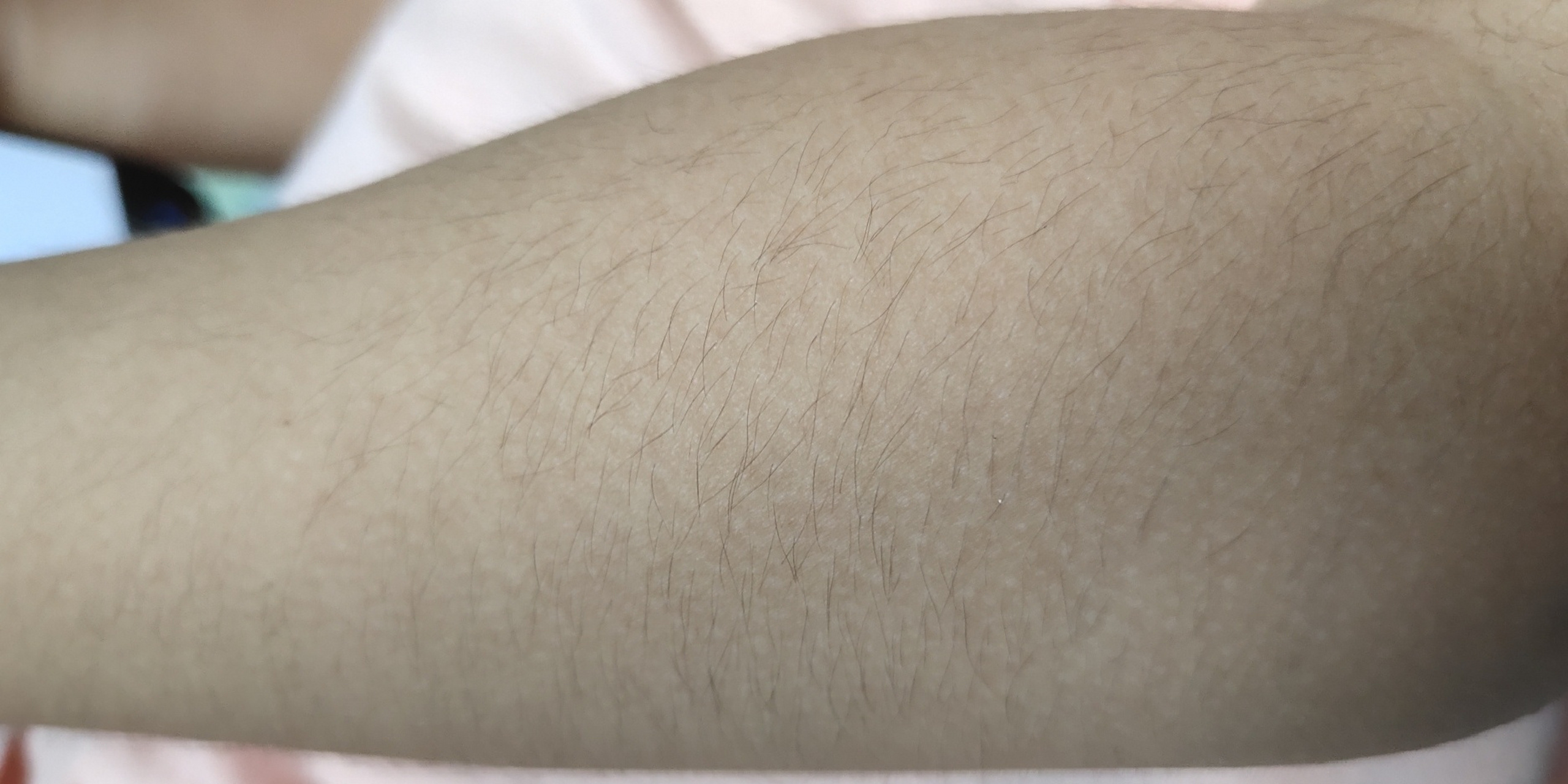 四岁孩子的体毛 儿子四岁了,这四肢的体毛还是如此多,大了 还能褪吗?