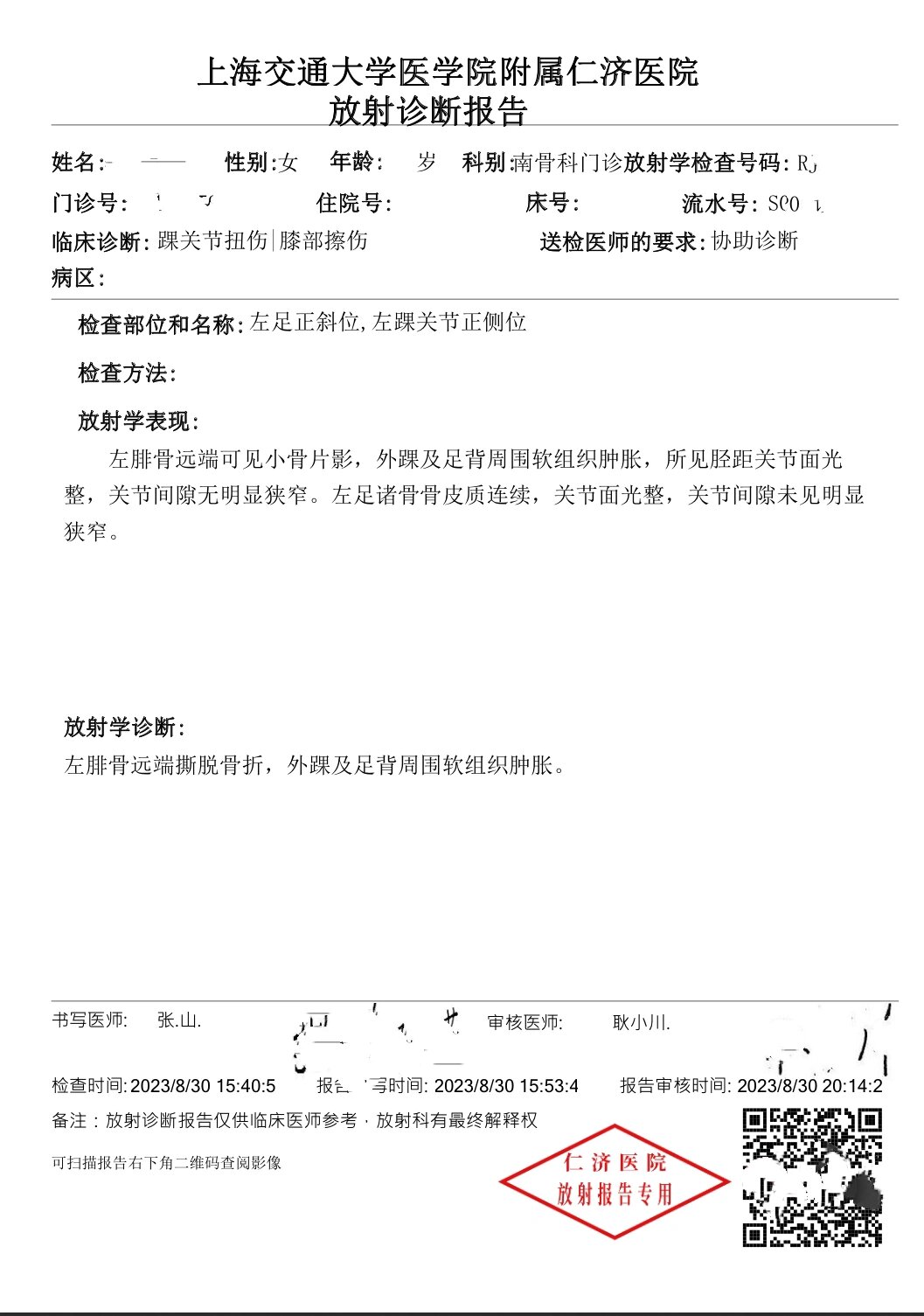 左腓骨远端撕拖骨折 摔伤: 8/26号周六,路边踩空台阶摔倒,左脚脚踝