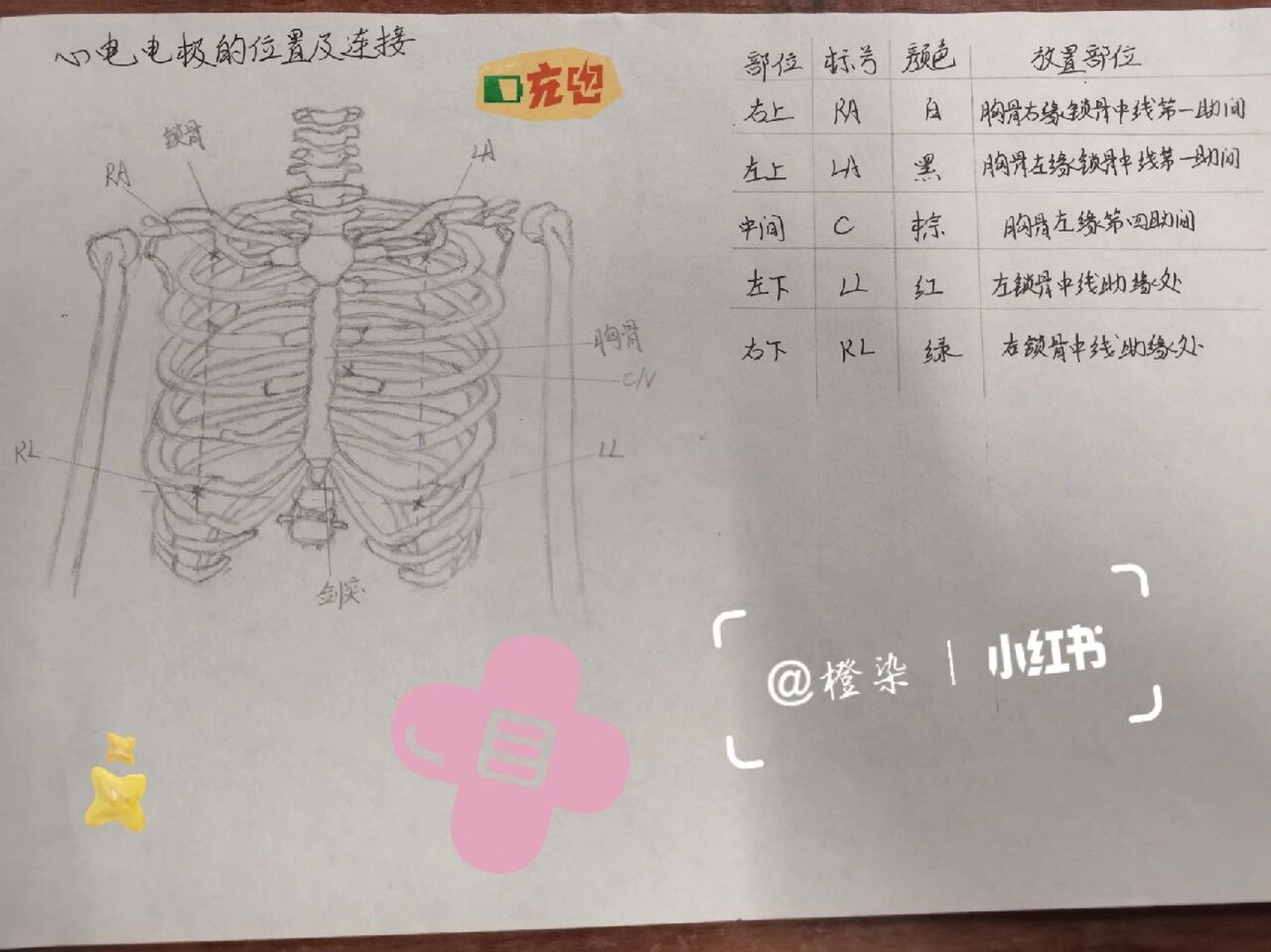 心电电极的位置及连接