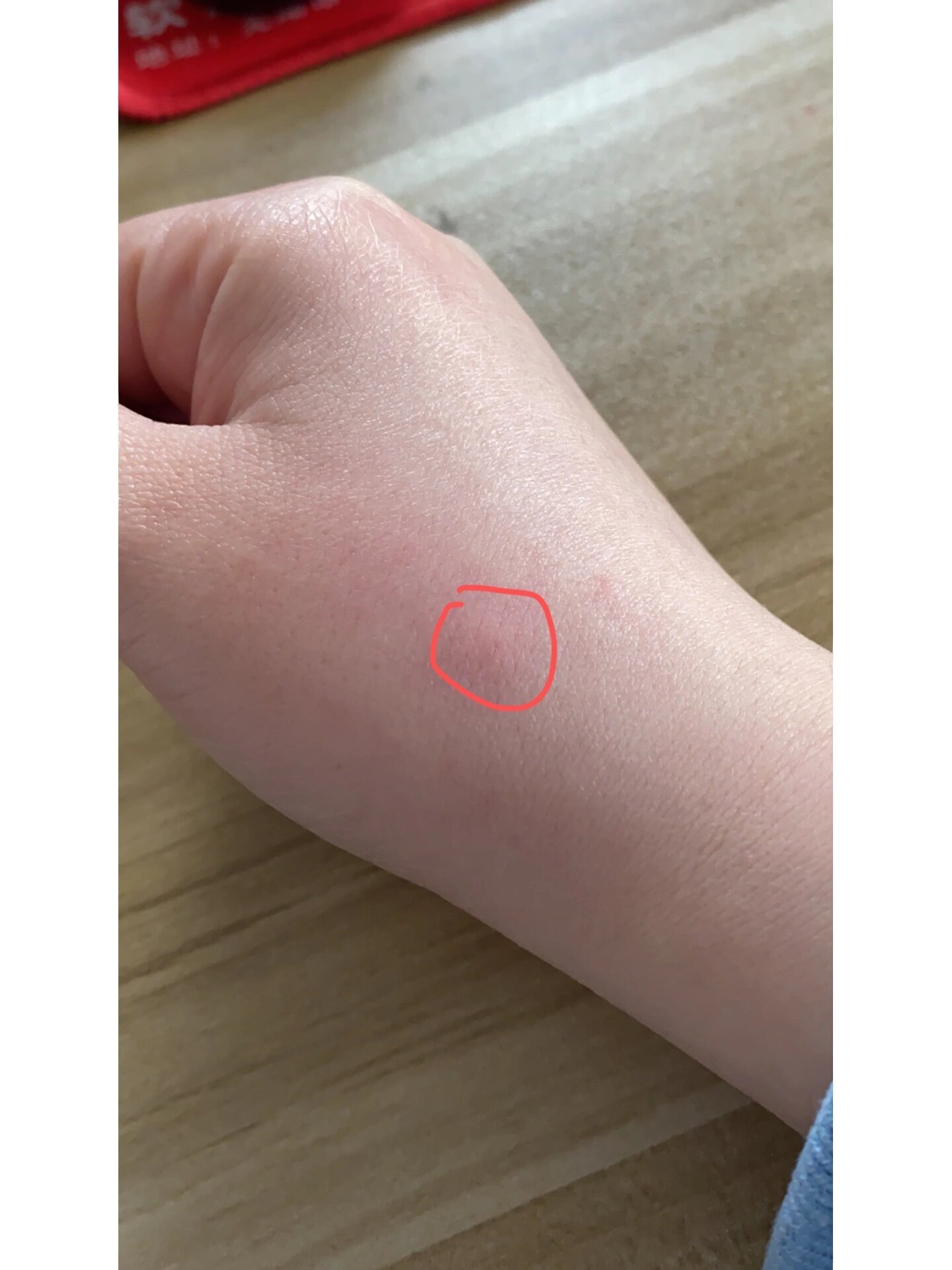 猫咪咬了针眼大小伤口需要打疫苗吗?求助!