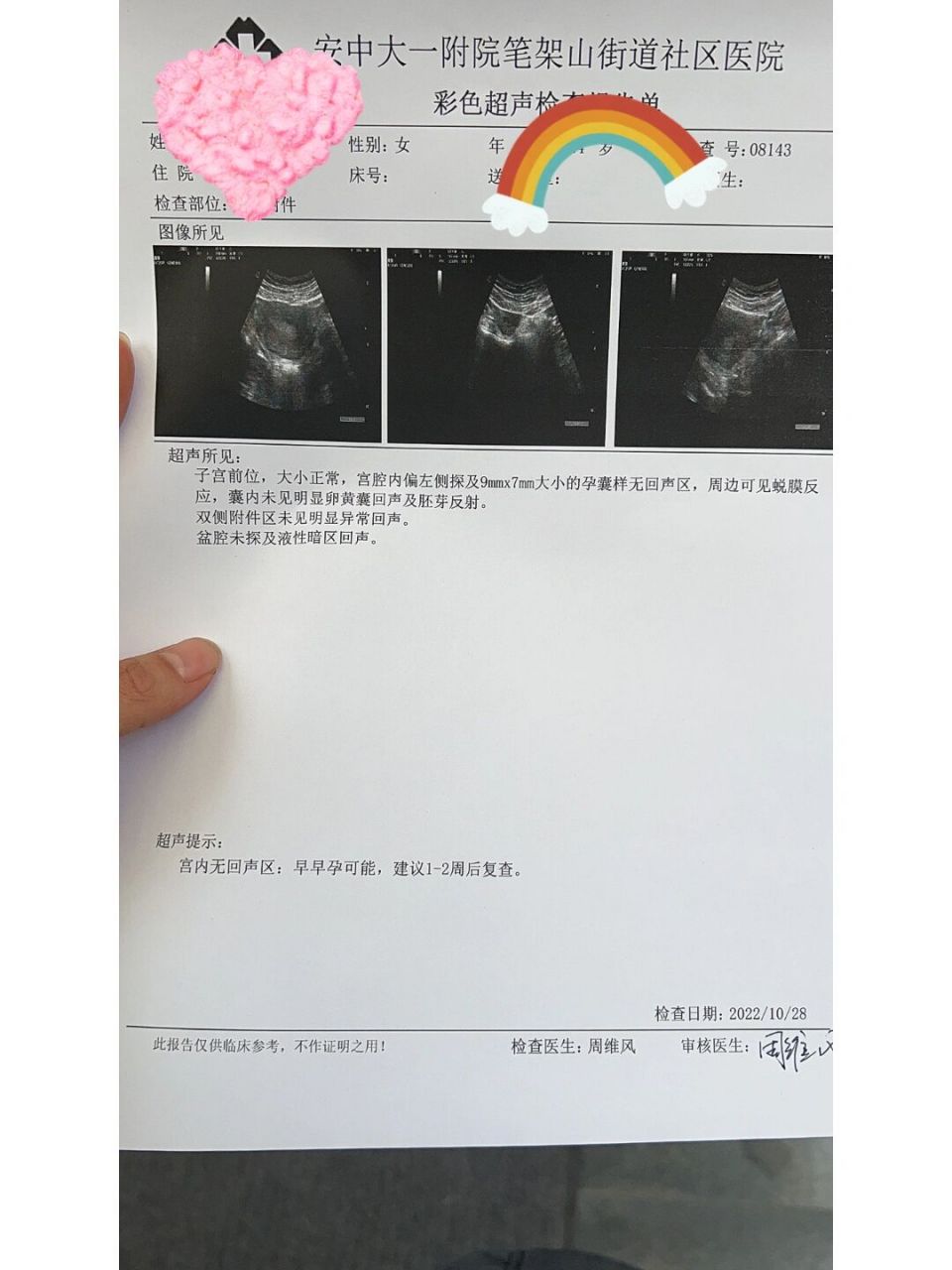 怎样知道孕囊掉了图片