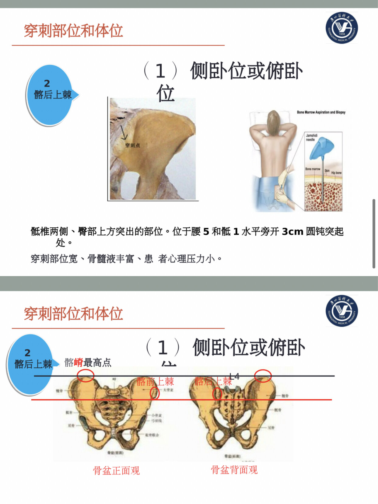 骨髓穿刺术的学习笔记