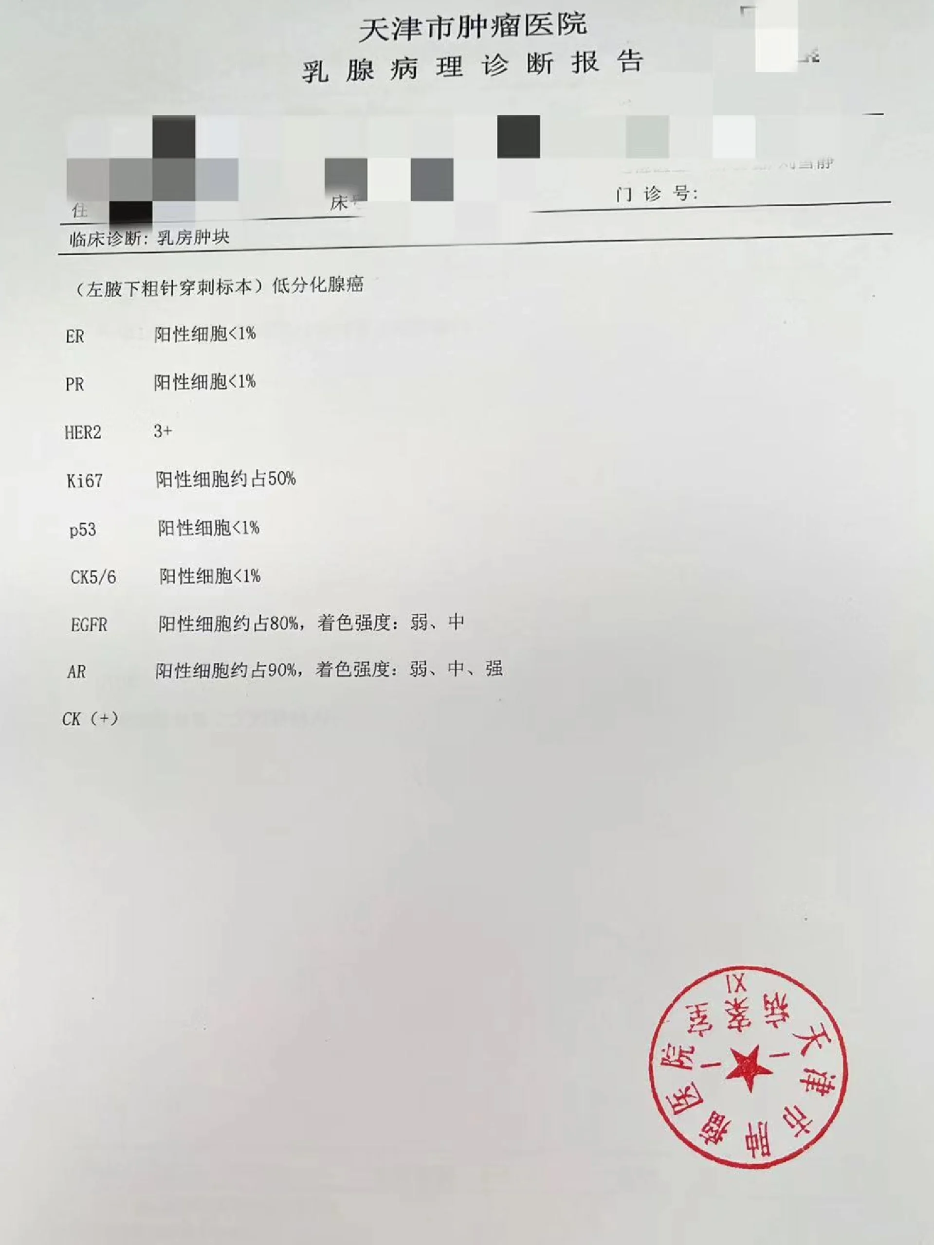 两阴一阳乳腺癌新辅助治疗方案 输液港 新辅助治疗方案 妈妈确诊乳腺