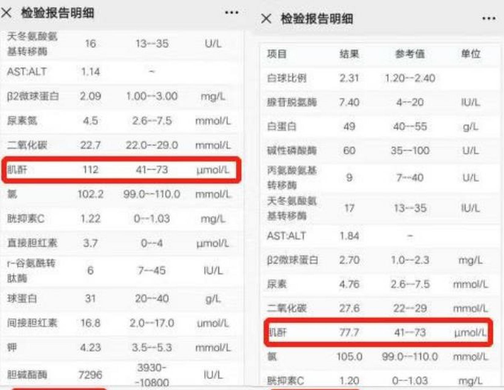 血肌酐偏低图片