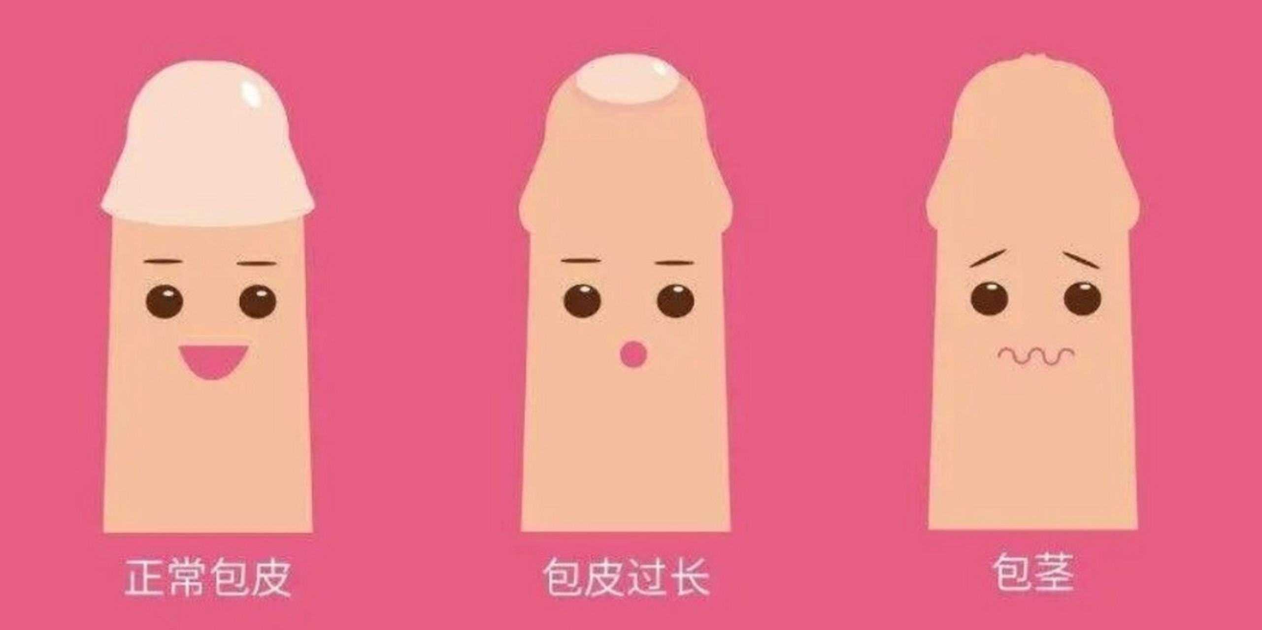 包皮过长其实在男性人群中是很常见的,不过,因为没有意识到包皮过长