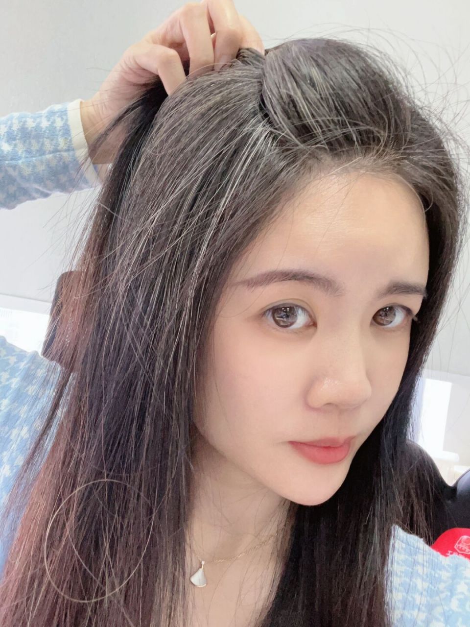 朋友说我满头白发,跟我出街很丢人 因为染头发掉发严重 我不染头发