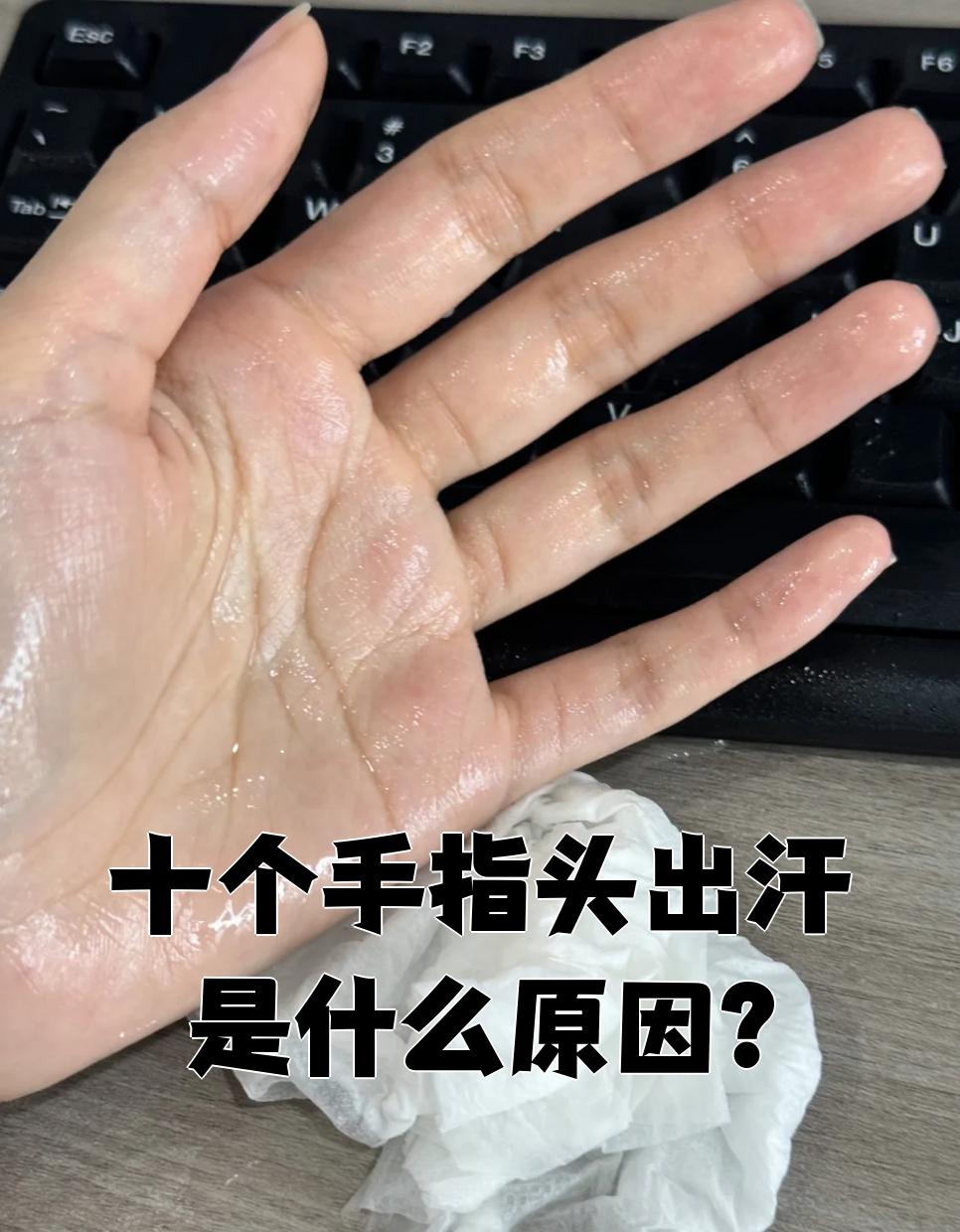 为什么头出汗特别多呢为什么在线