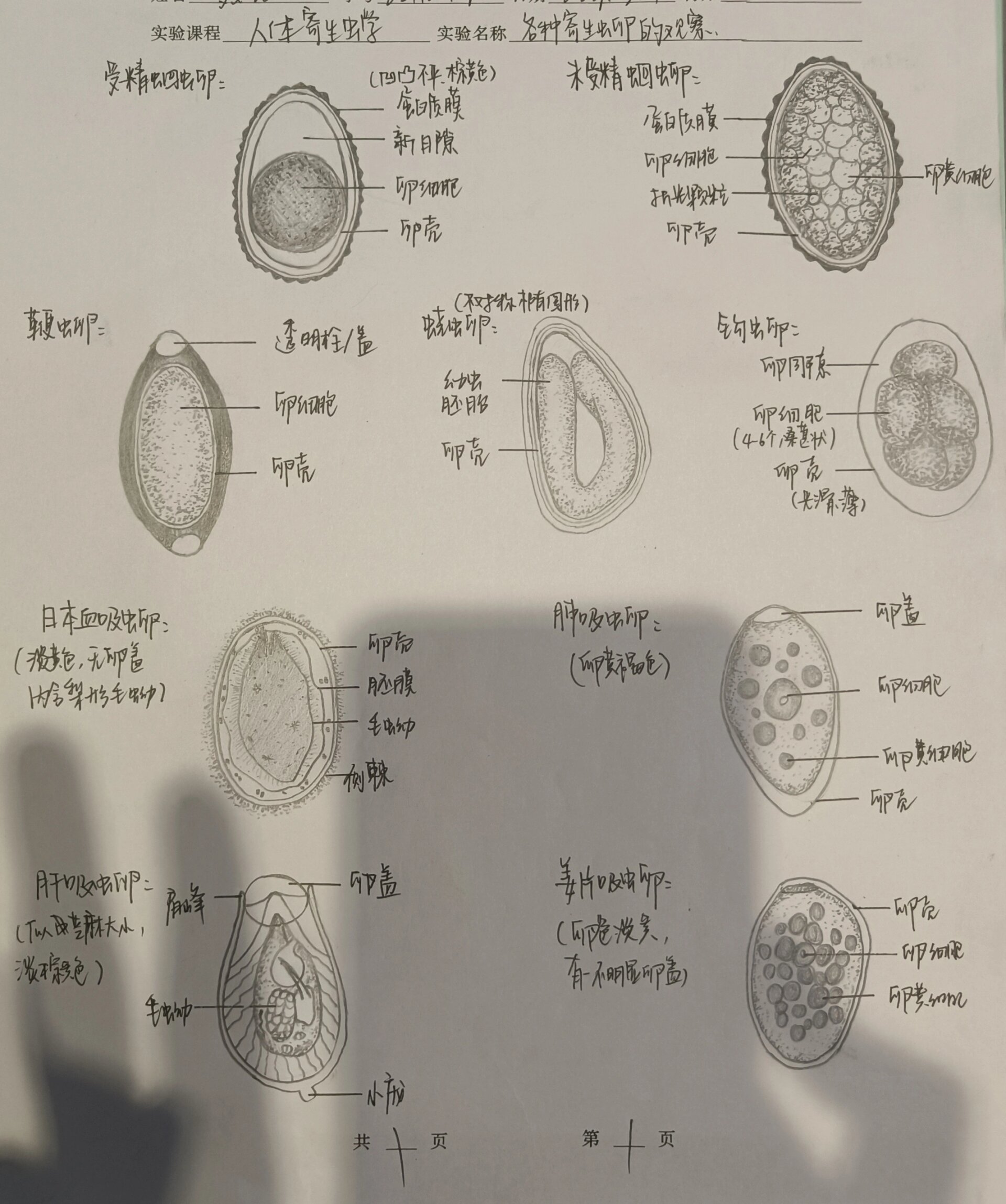 肠吸虫卵手绘图片