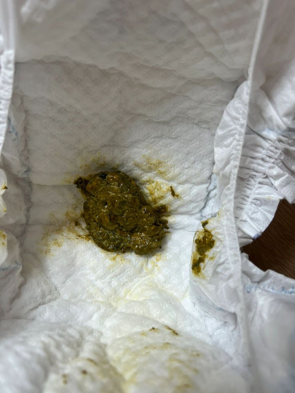 喝了氨基酸奶粉的便便这样是正常的吗 还没满月的宝宝喝氨基酸奶粉一