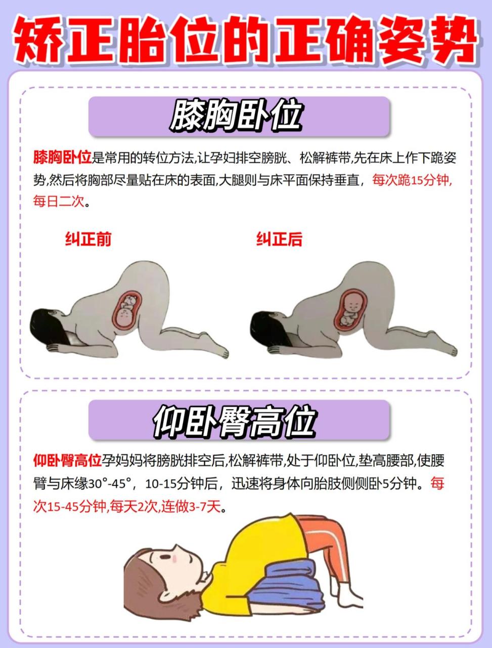 孕期小知识:胎位的重要性 🤰🏻孕晚期很多的妈妈都会遇到胎位不正