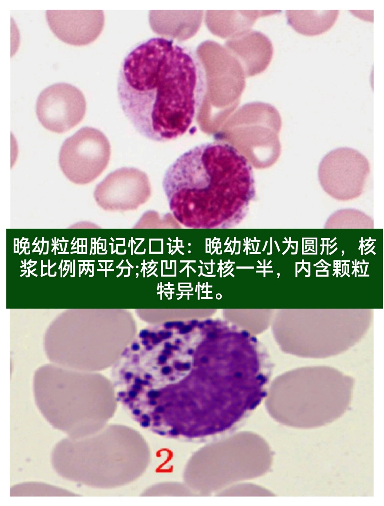 杆状核粒细胞图片图片
