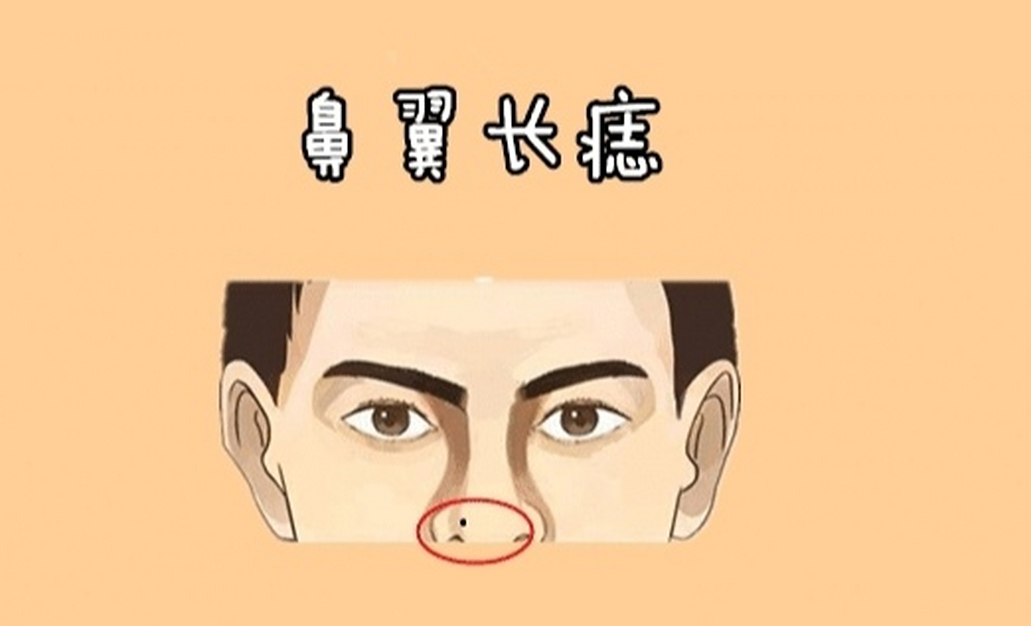 鼻翼有痣:长在哪里的痣代表着事业运旺 虽说鼻子是面部中的财帛宫