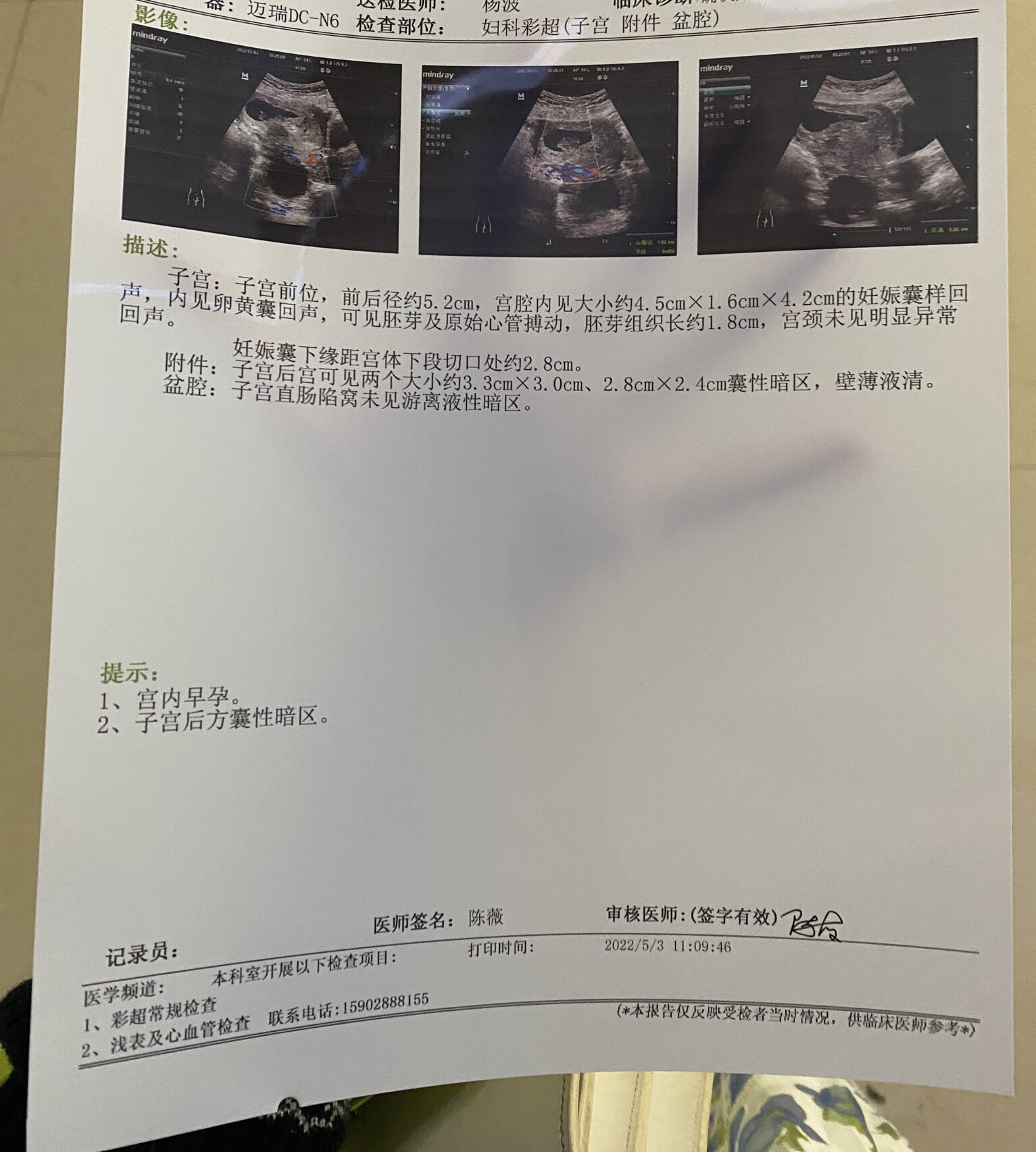 经历了孕早期见红 差不多断断续续两周左右