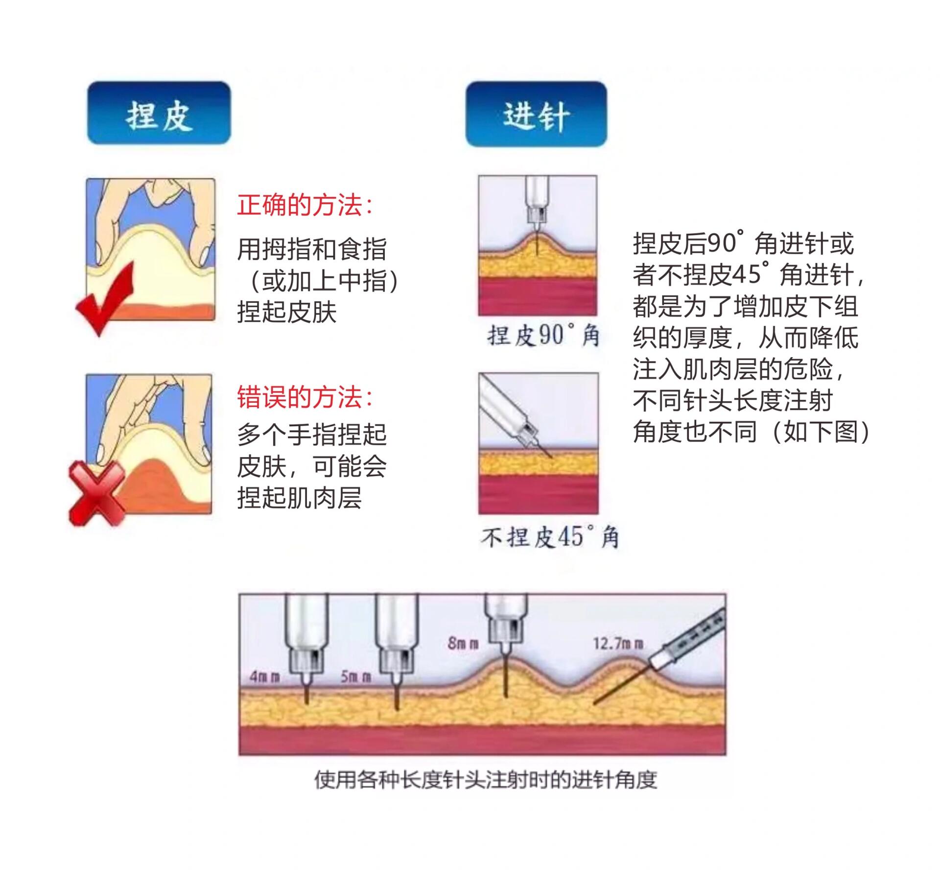 肝素的注射位置图片