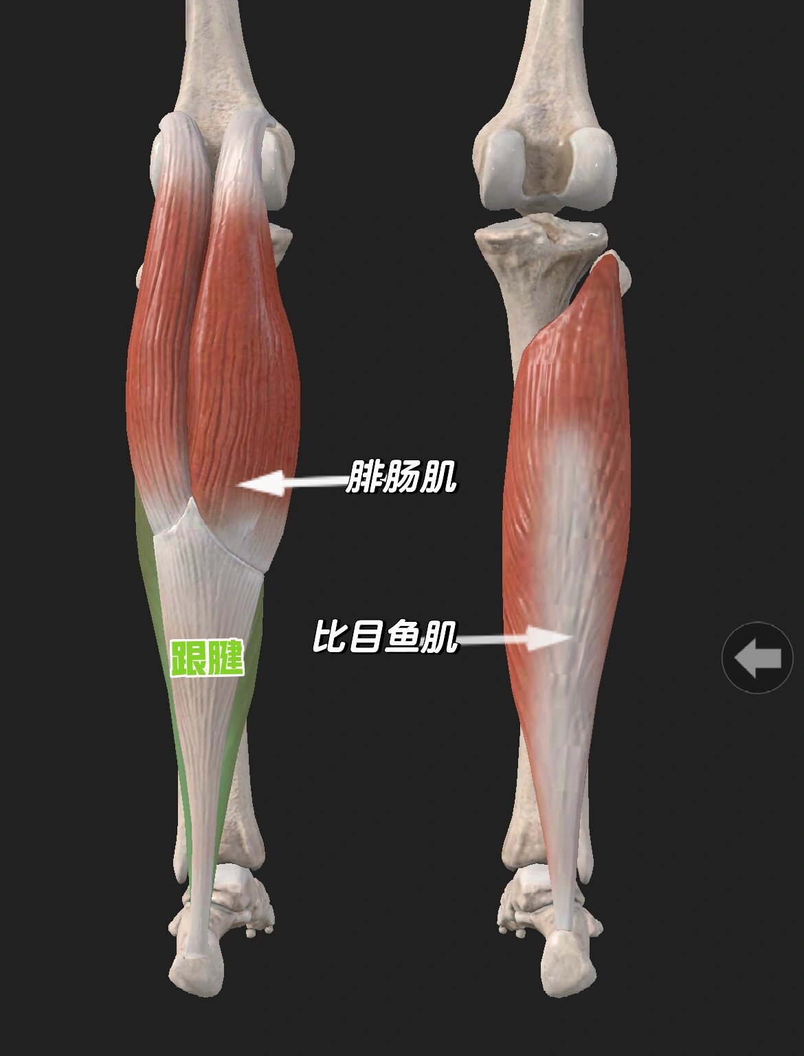 腓肠肌内侧头图片