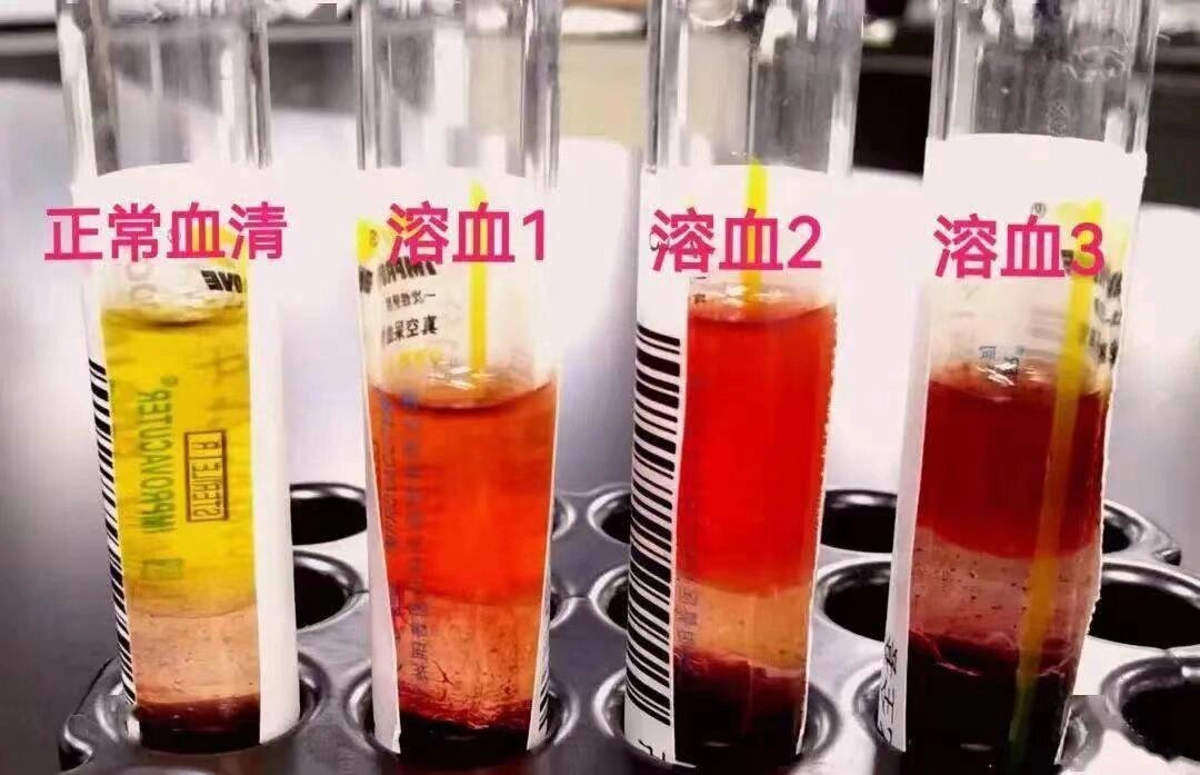 血清和血浆样本的区别,制备和保存 在日常实验中,血液是大家经常会