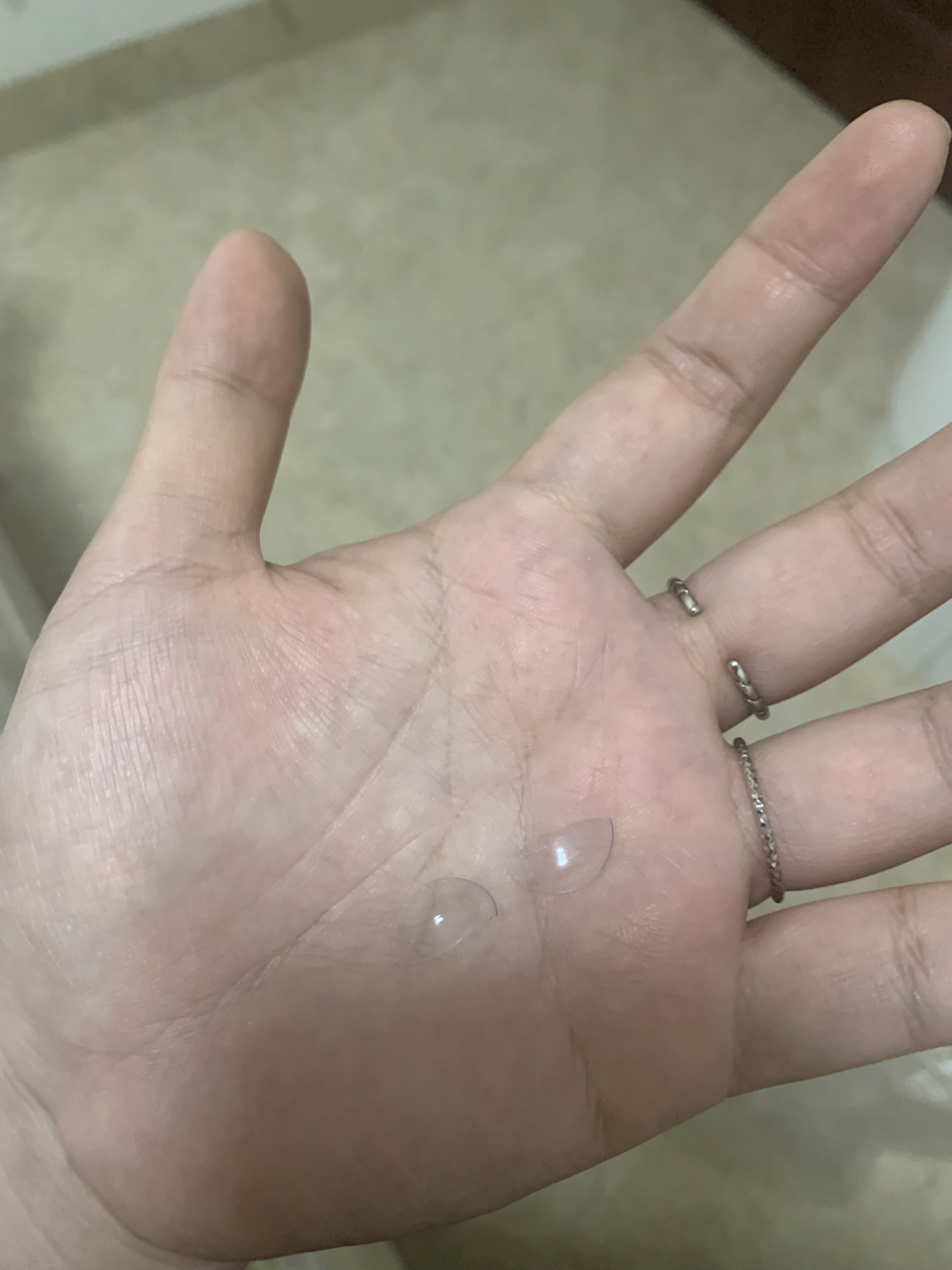 隐形眼镜在眼睛里碎成两半!
