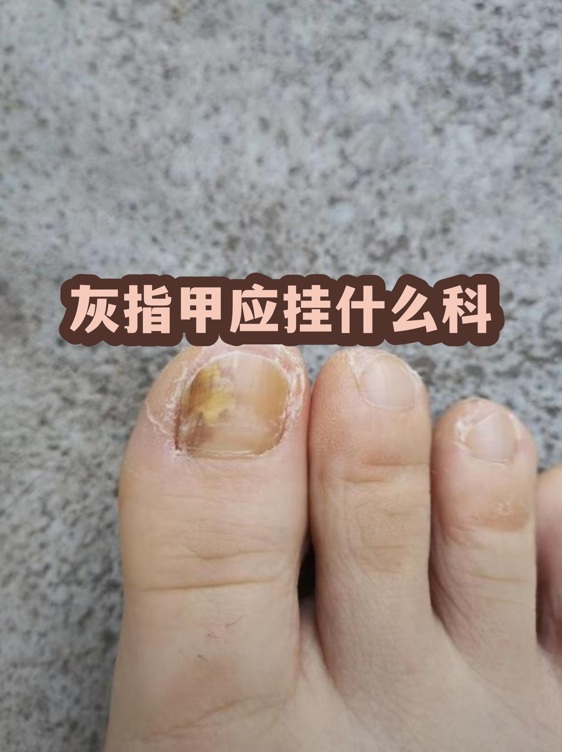 东直门医院代取报告代挂号让就医更轻松，北京中医药大学东直门医院是否有线上门诊