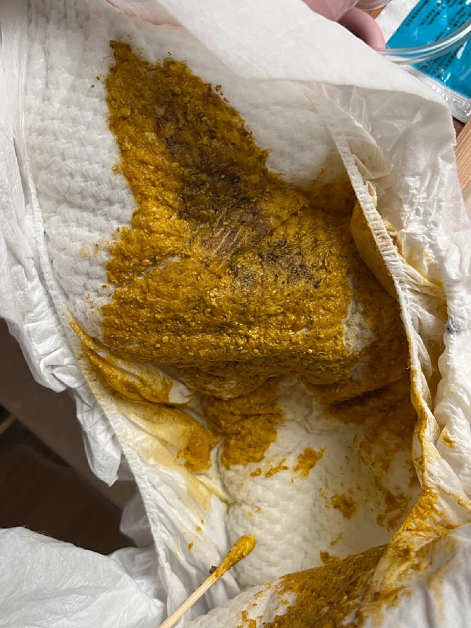 两个半月宝宝大便奶瓣多 有点点棕色正常吗 水样 喝奶的时候肚子经常