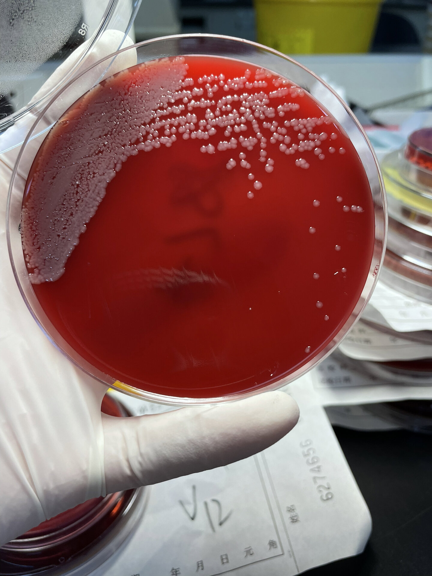 鲍曼不动杆菌 镜下革兰阴性杆菌