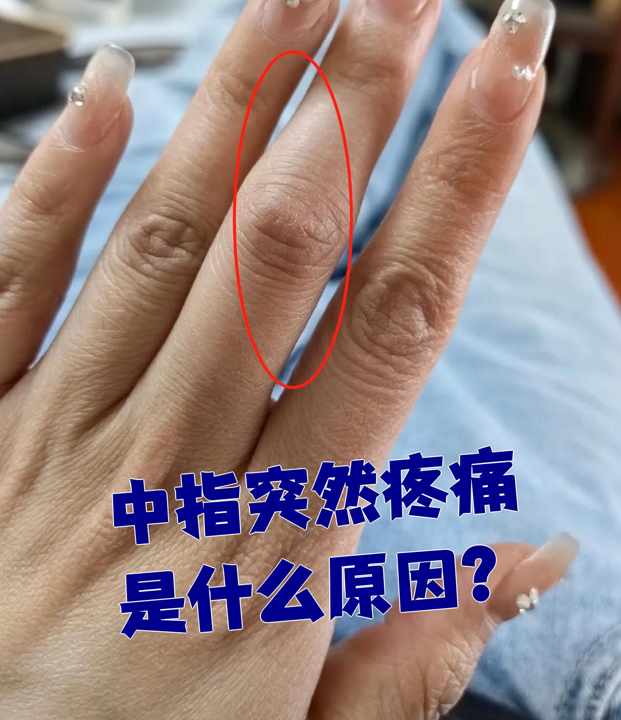 但最常见的是劳累过度或者受凉导致的手指肌肉痉挛,一般休息一下就能