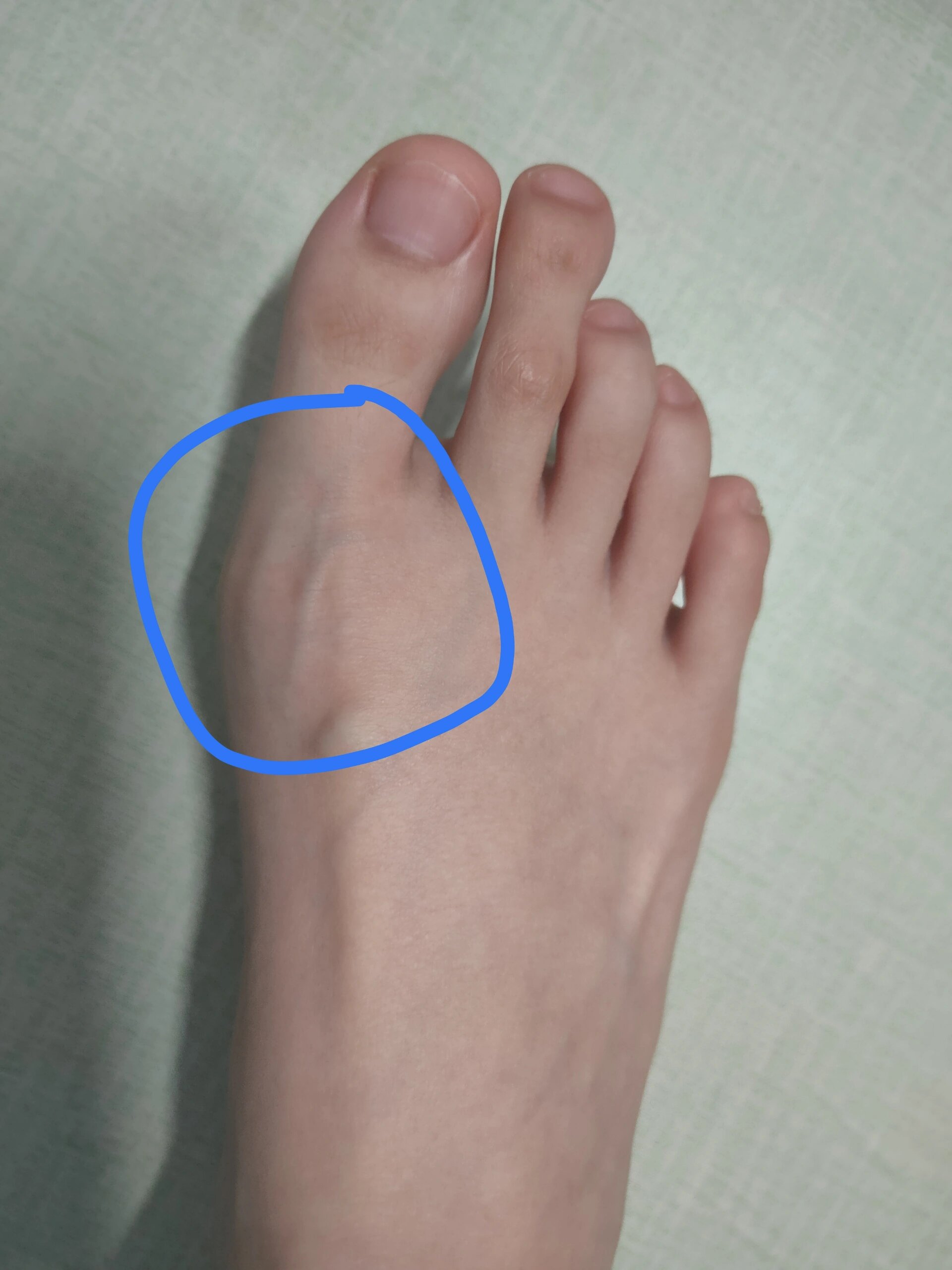 大拇脚趾好痛,怎么回事啊