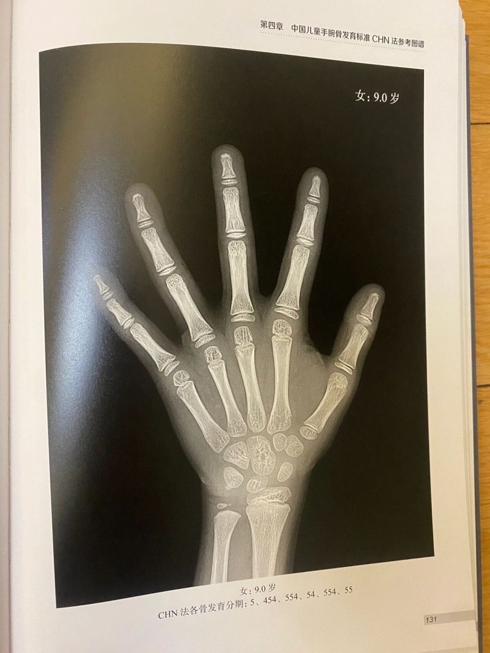 《中国儿童手腕部骨龄评测标准—chn法与参考图谱》 	 仅供参考