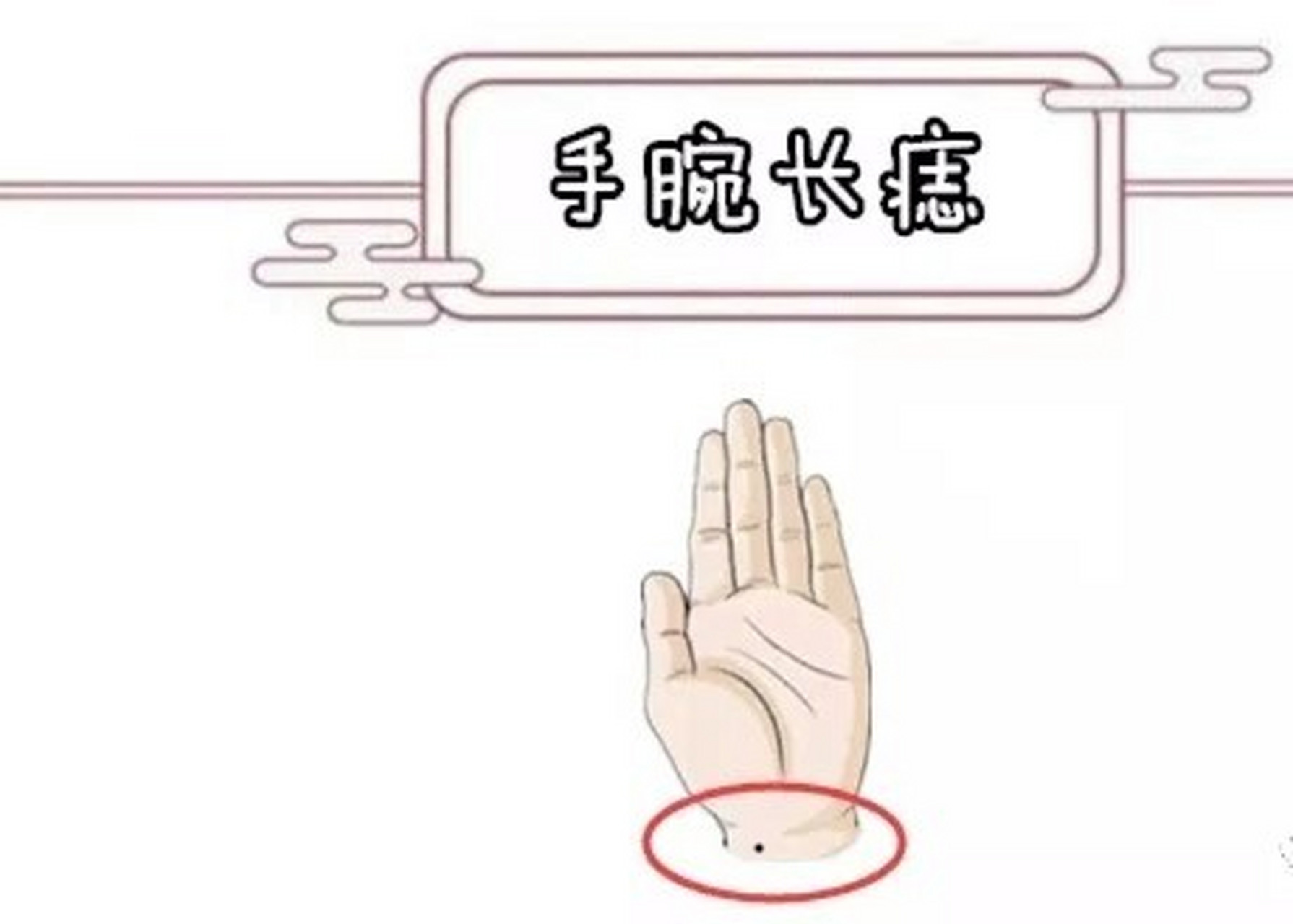 手腕长痣的意义