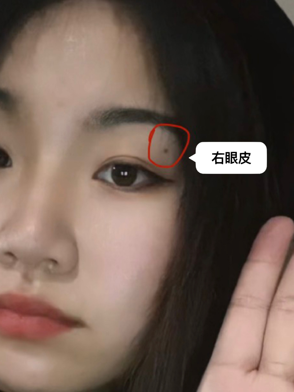 右眼皮上的痣.    右眼皮这个位置上的痣,大家知道是好的还是坏的 ..