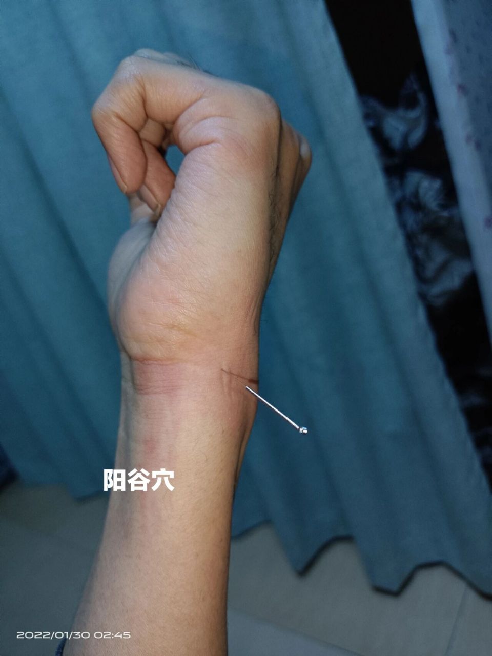 自学针灸 - 阳谷穴 顺着小指头骨头往下摸,到腕横纹下一点,有个凸起来