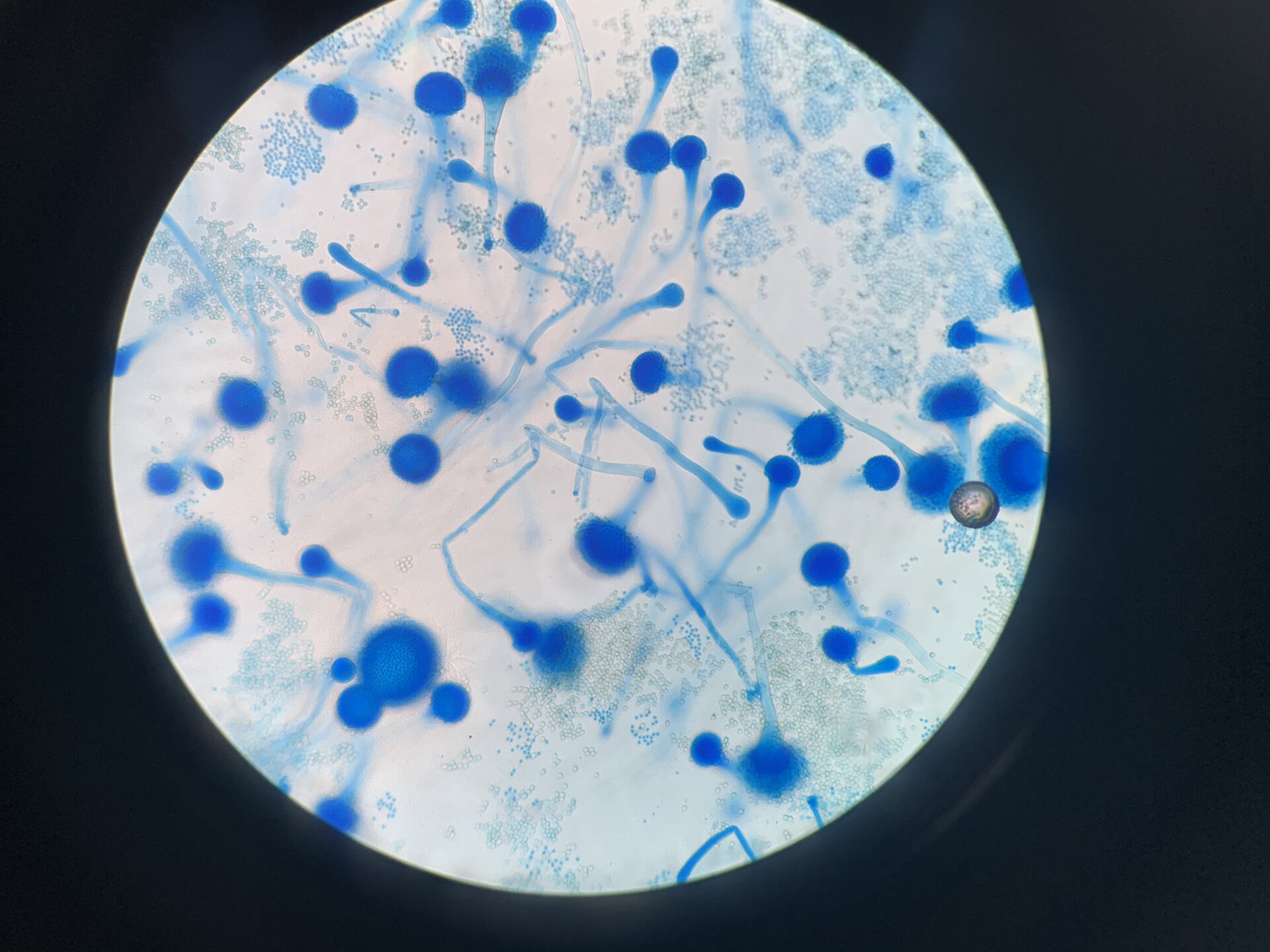 烟曲霉, 顶囊成倒立烧瓶状,单层小梗布满顶囊4/5.