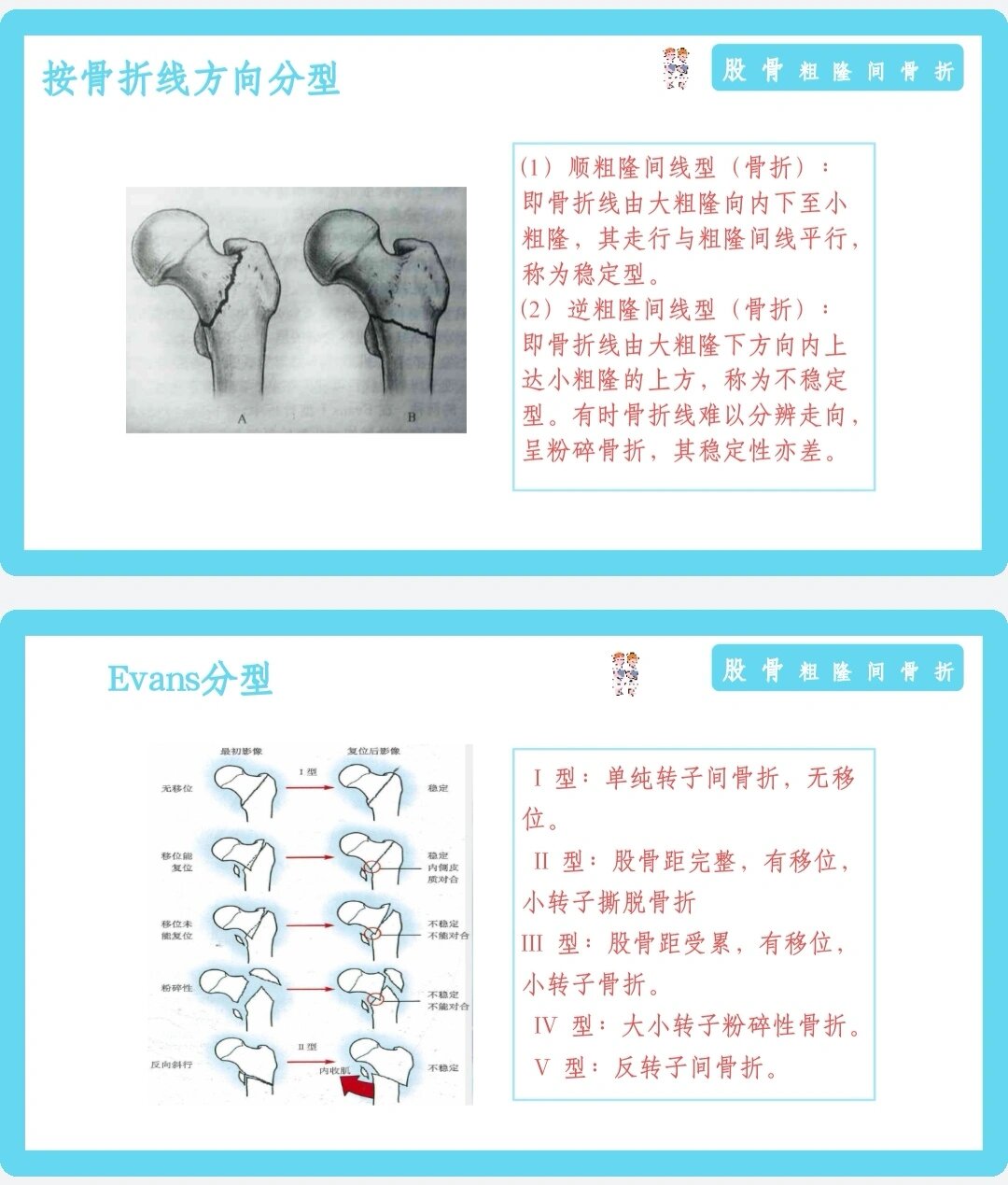 小粗隆骨折图片解剖图片