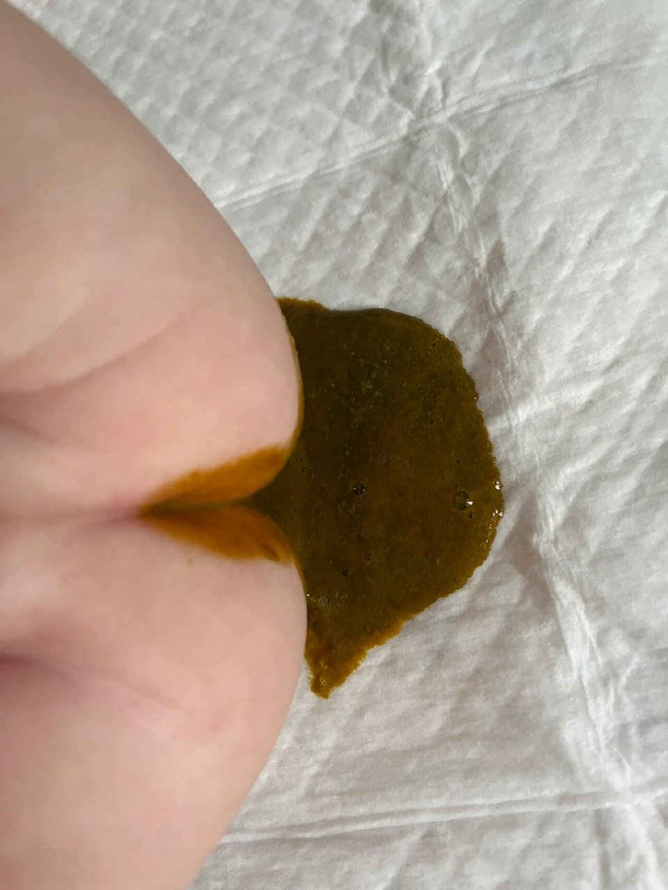 宝宝吃了醒脾养儿颗粒便便有点绿 宝宝积食舌苔很厚,小儿推拿做了很多