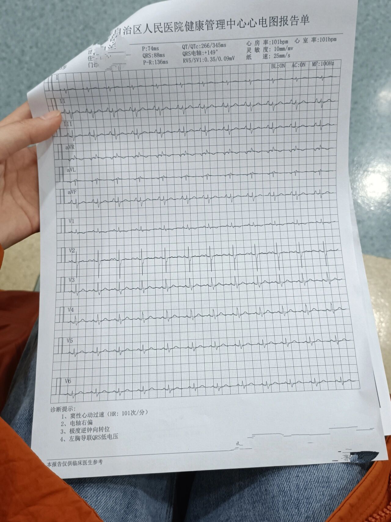 银行体检 体检因为有点紧张,内科检查医生给我写心率不齐,心电图结果