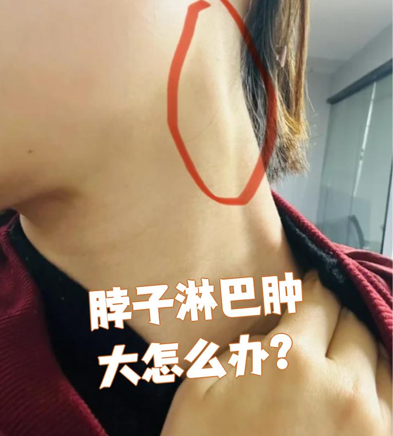 脖子淋巴肿大需要先去医院检查,明确具体病因