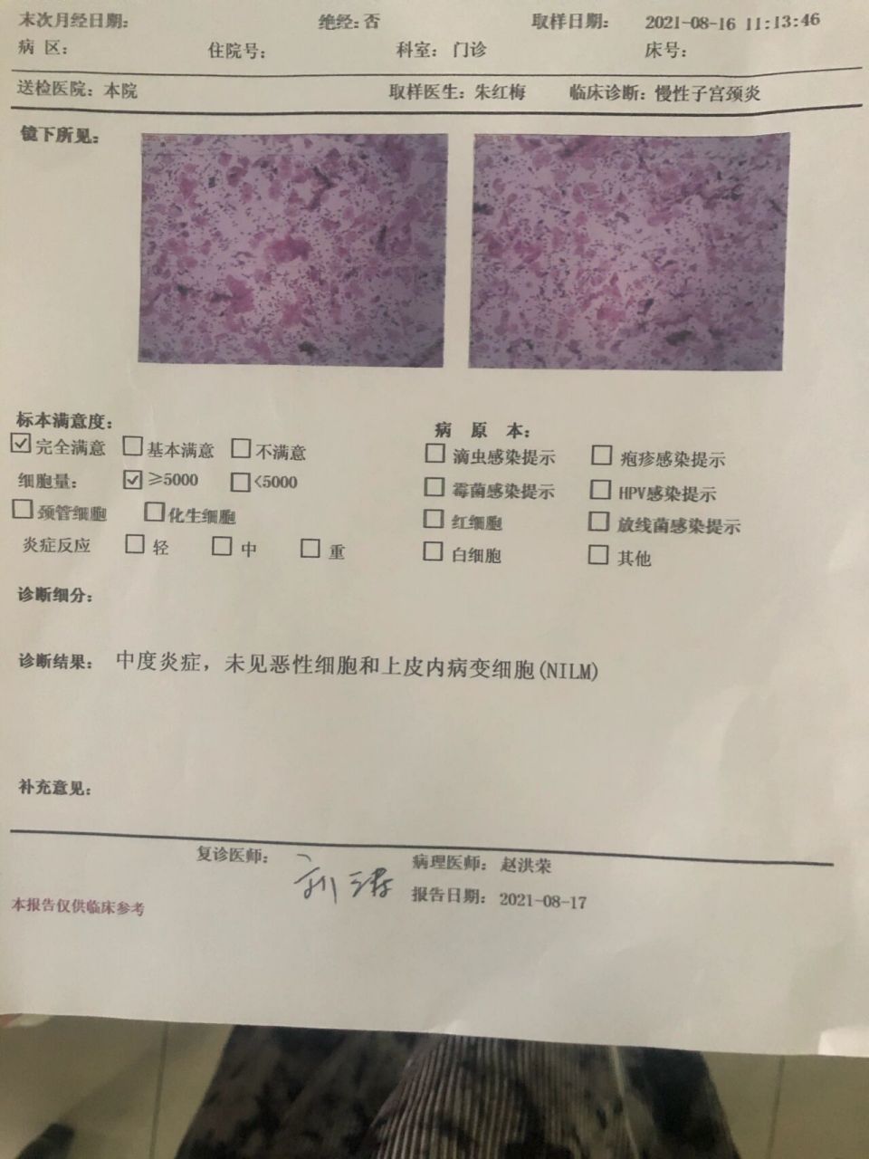 淘米水白带宫颈癌图片图片