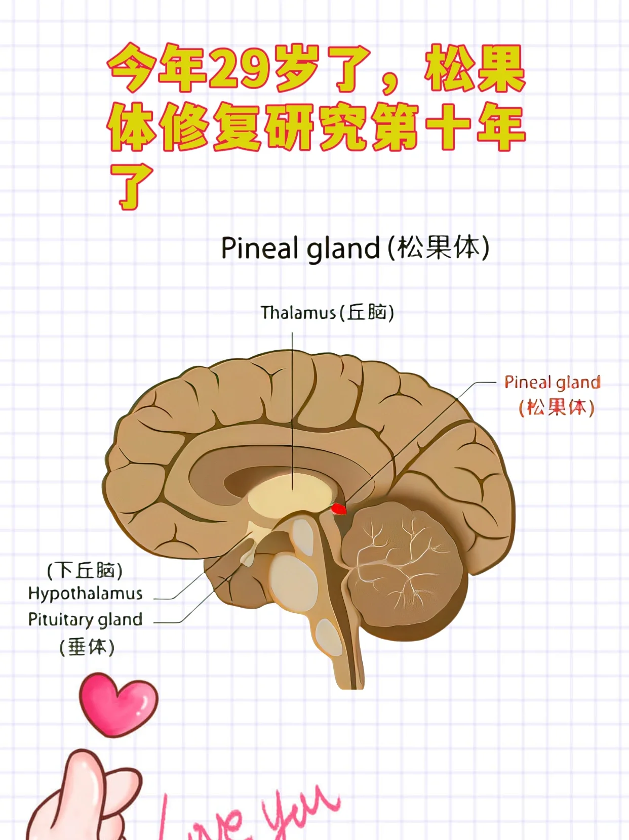 松果体钙化图片