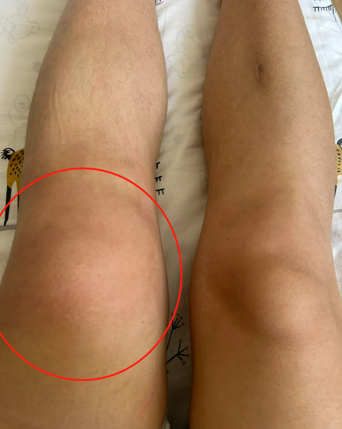 如果出现这些症状,要尽快去医院检查,找到具体原因后按医生的建议治疗