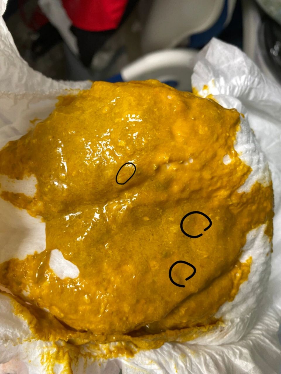 宝宝口服五价轮状疫苗后腹泻(内有便图) 宝宝月子里混合喂养,大便一直