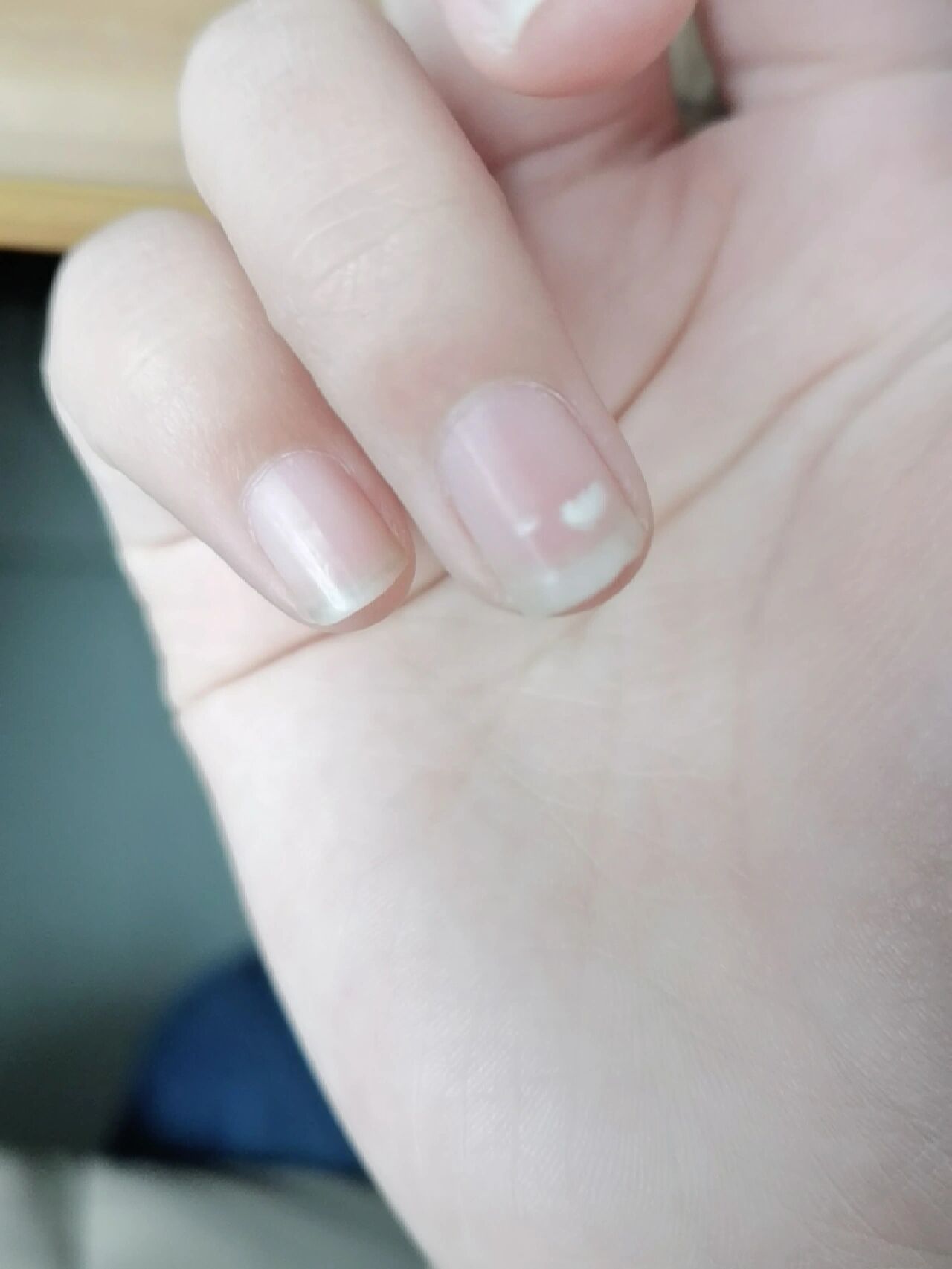 指甲盖上的白点是怎么回事吗?