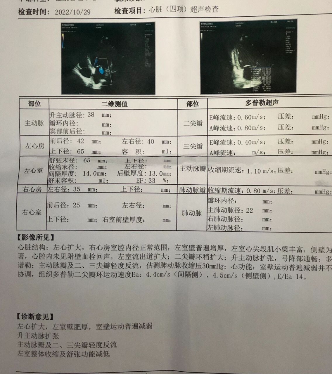 高血压体检报告图片