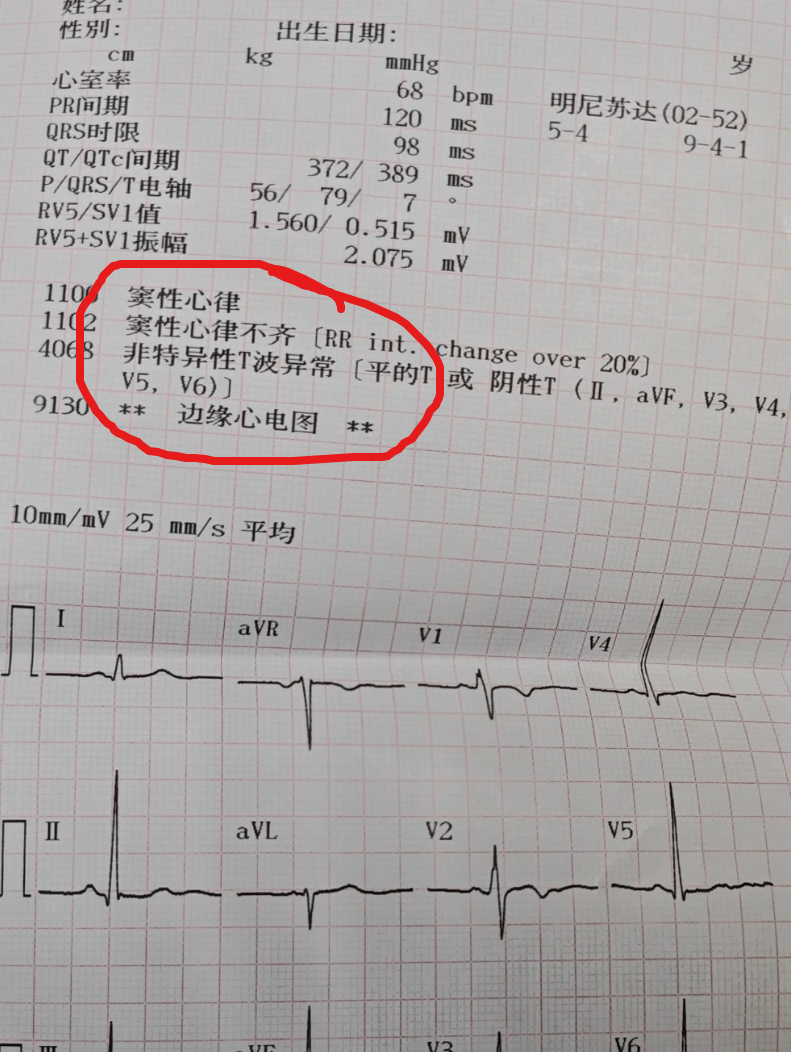 为什么会心律不齐