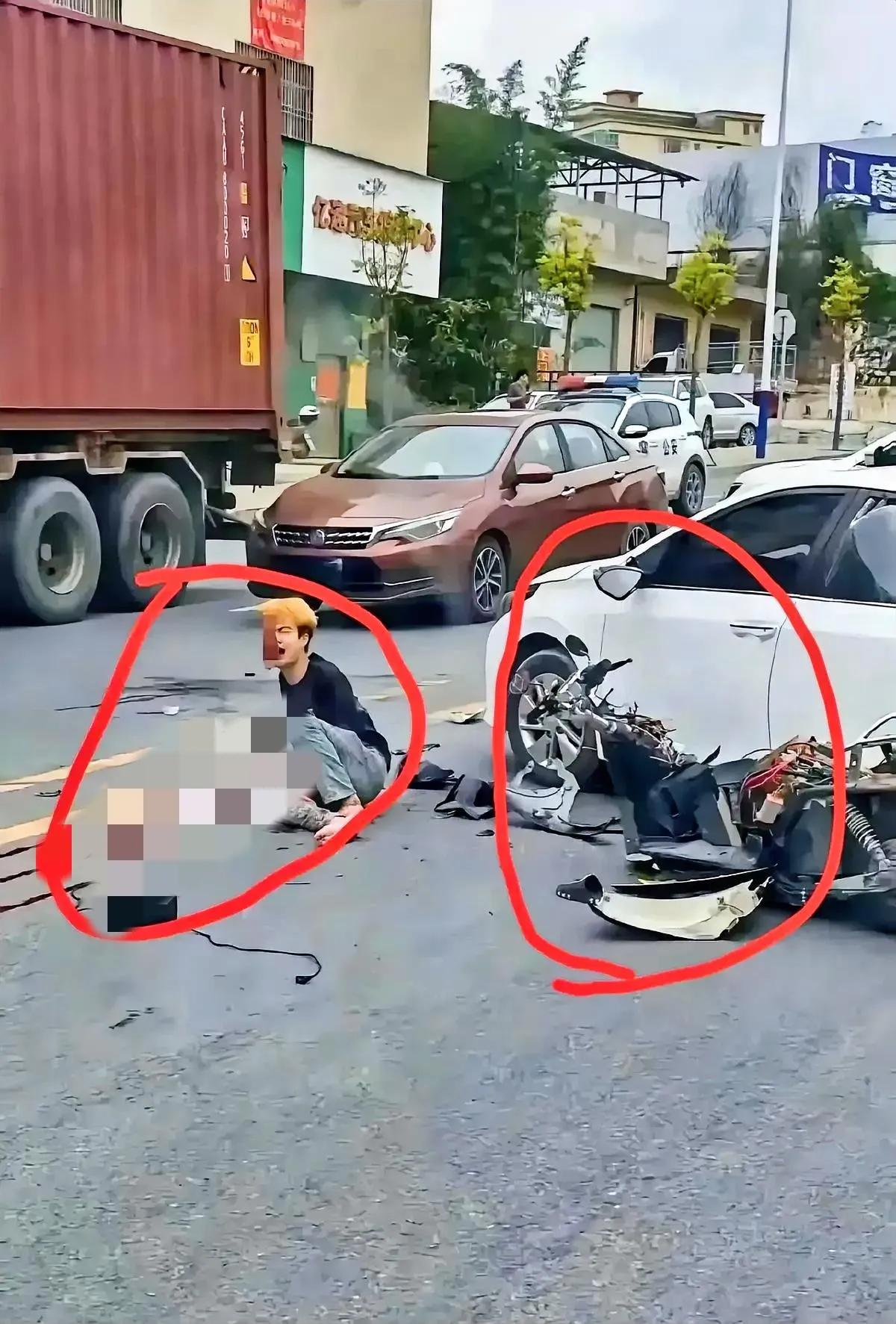 鬼火少年骑摩托车出了车祸,车被撞得稀巴烂,半边脸都破相了