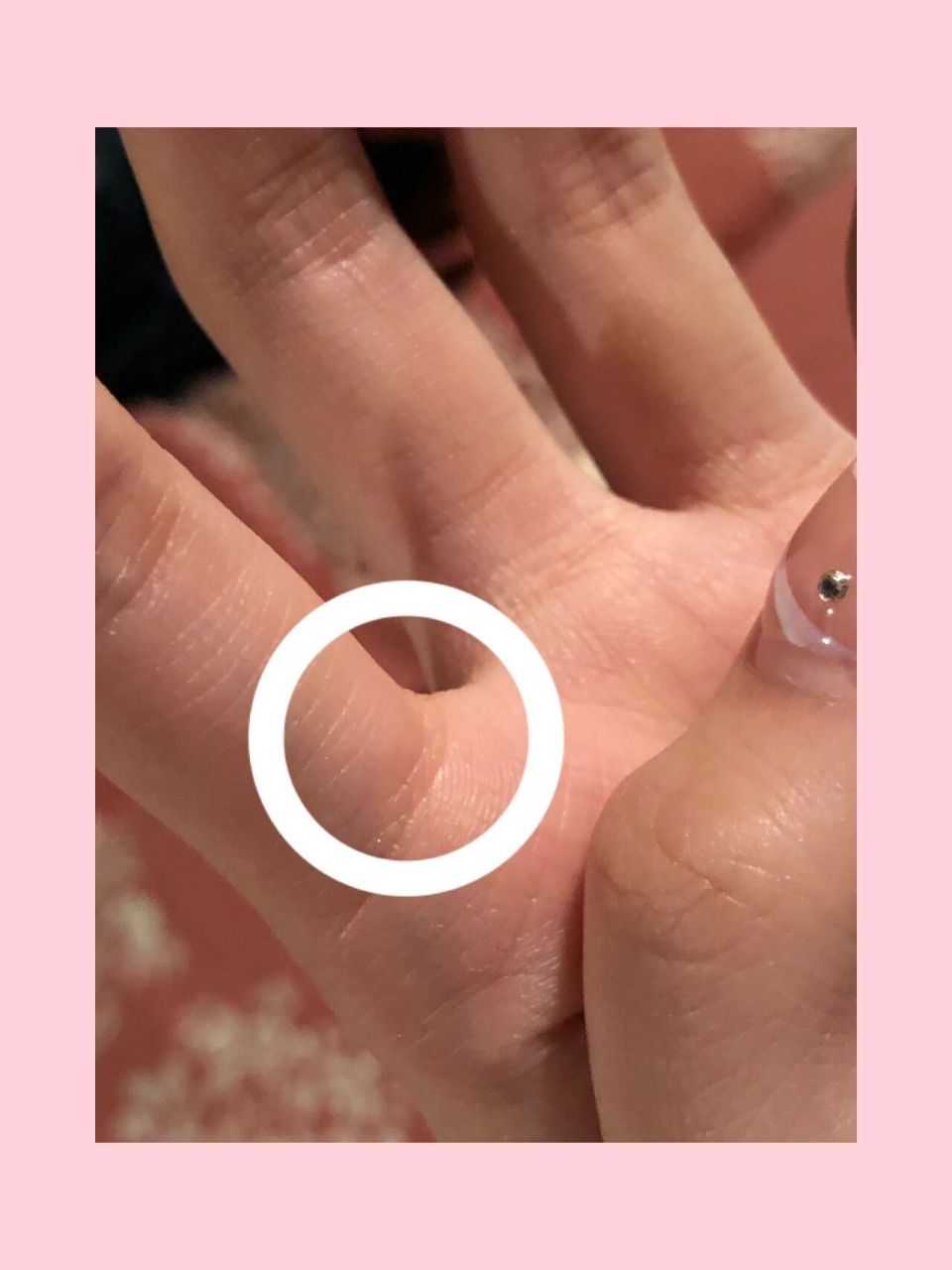 手指关节这里突然长了一个硬硬的包 看不出来但是一摸就能摸到硬硬的