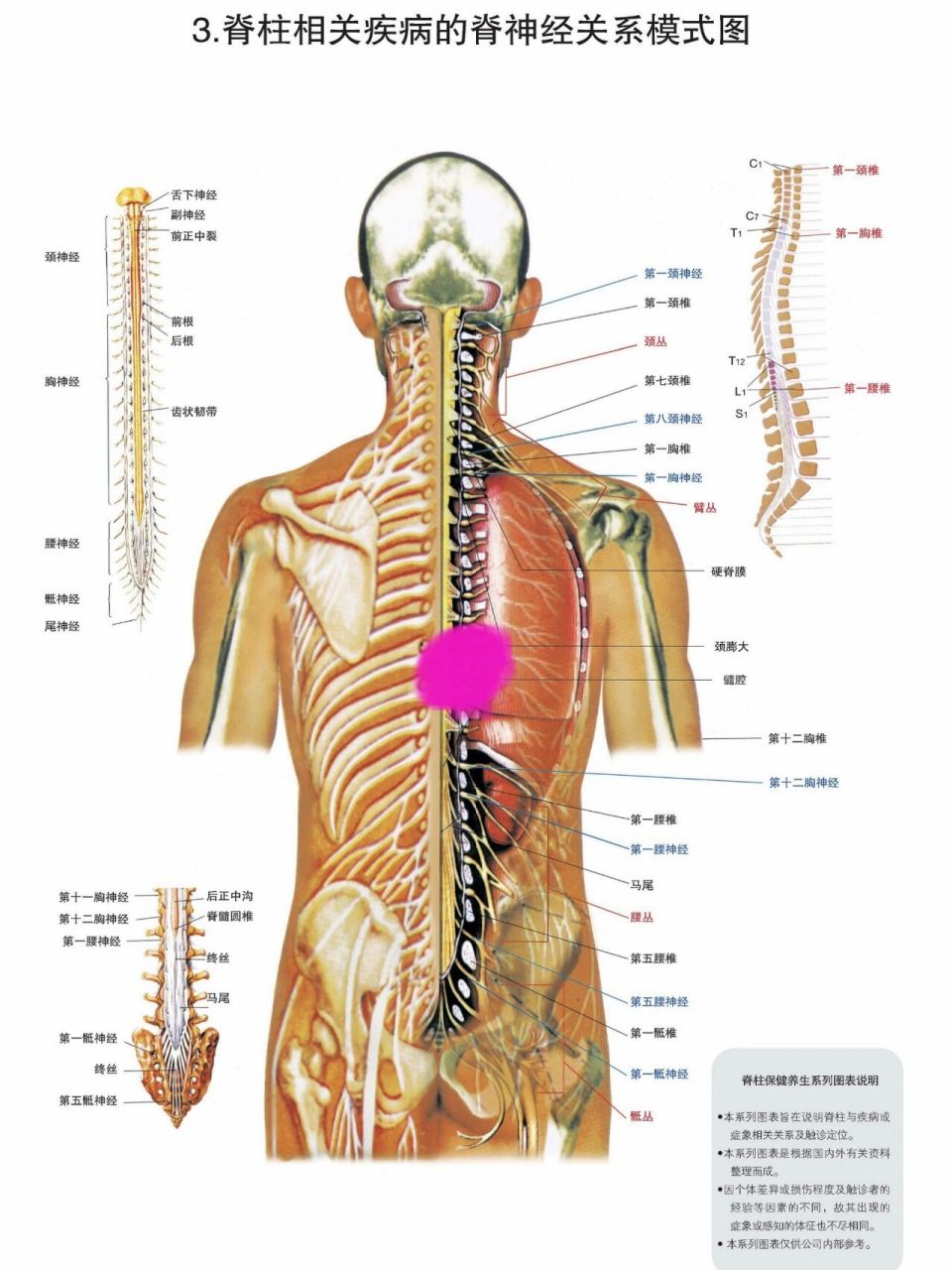 后背上部脊柱中间疼痛图片