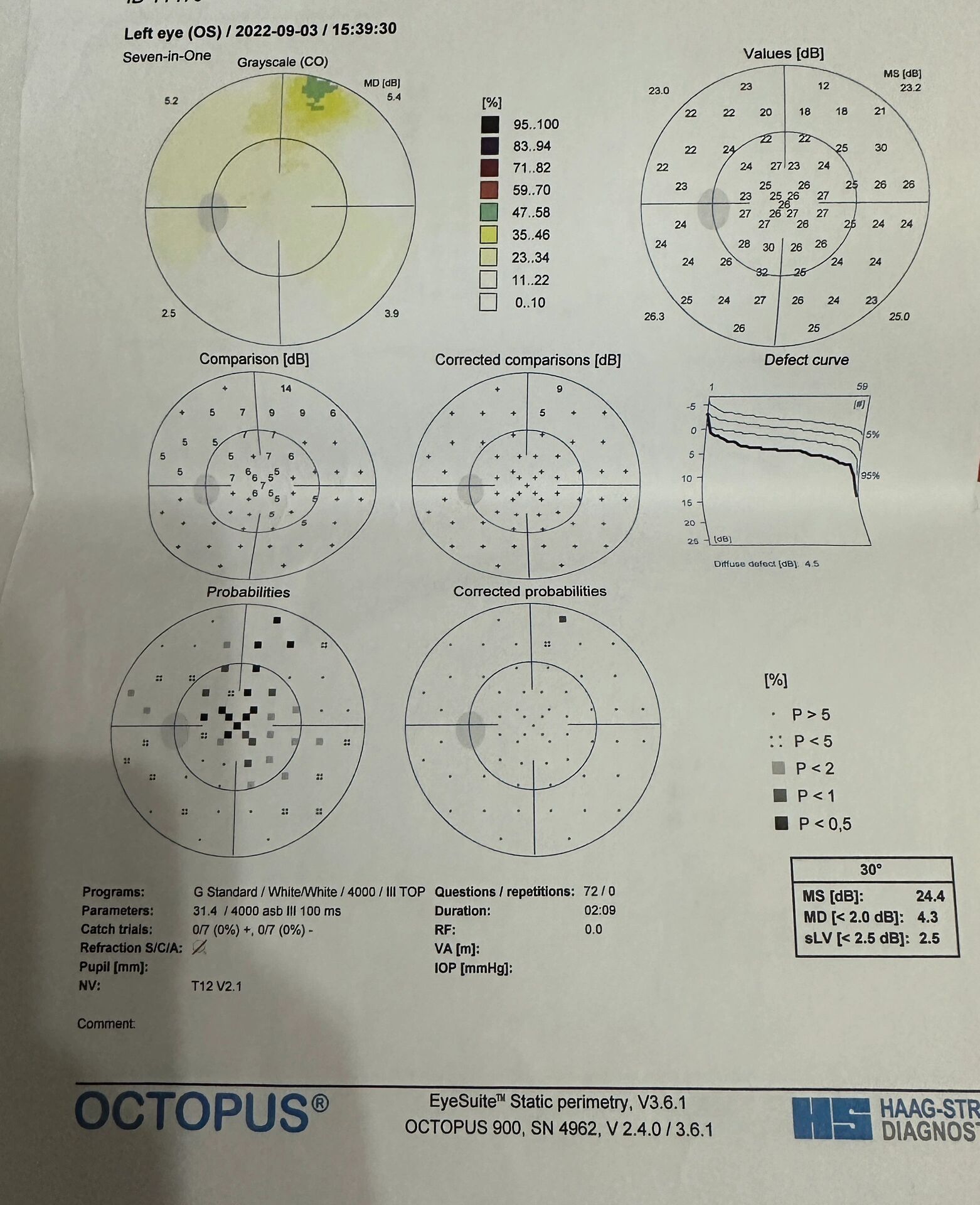 眼部检查oct报告怎么看呀
