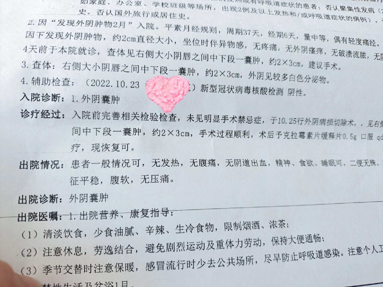 巴氏腺囊肿切除手术 又称前庭大腺囊肿,不痛不痒,就是长在太里面压迫