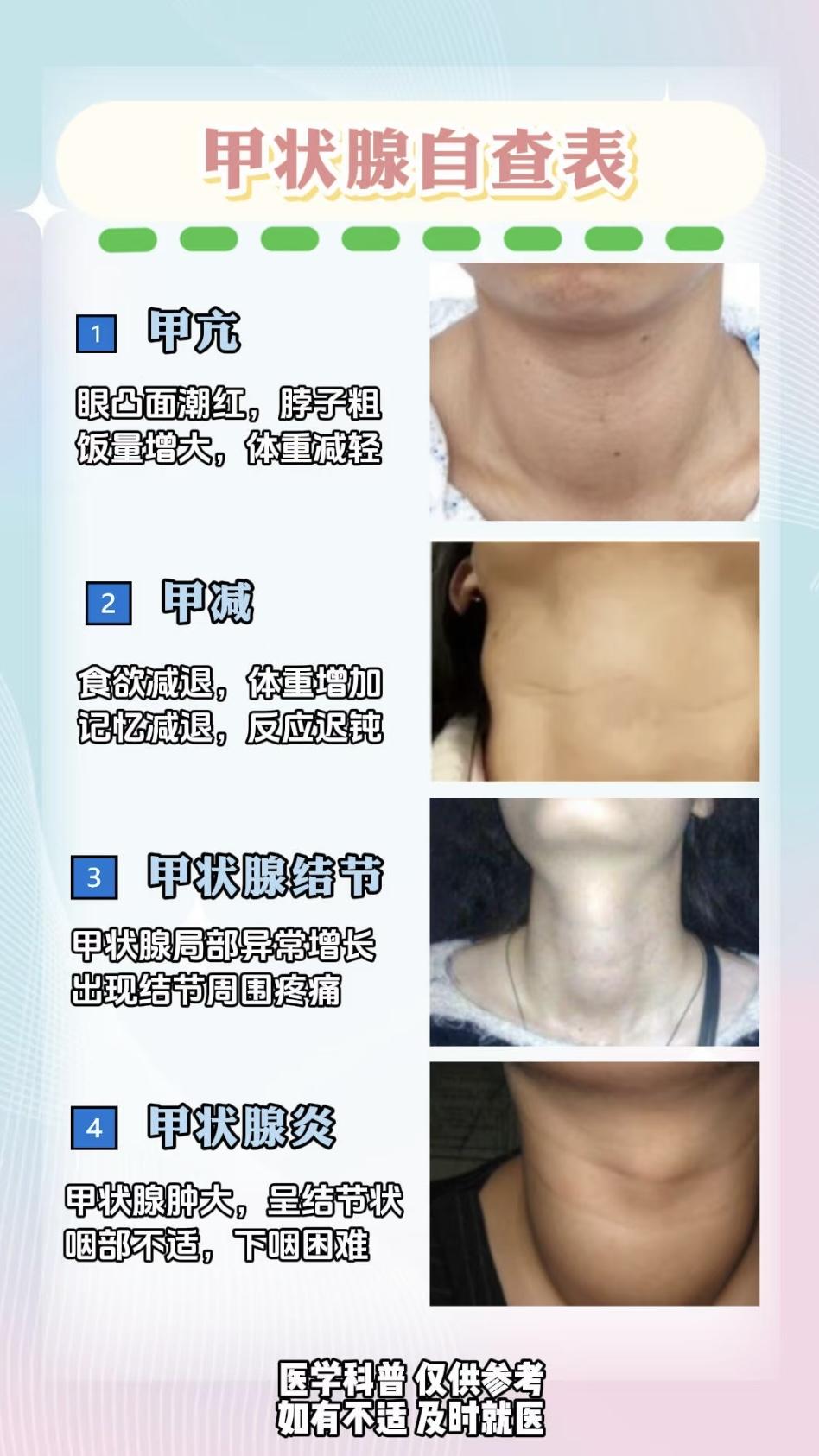 甲状腺好不好,看看脖子就知道~