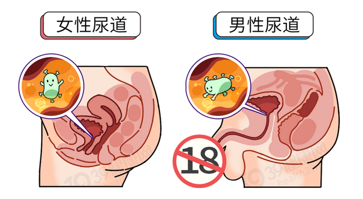 男女的3个不当行为可能让尿道承受不起别不把感染当回事