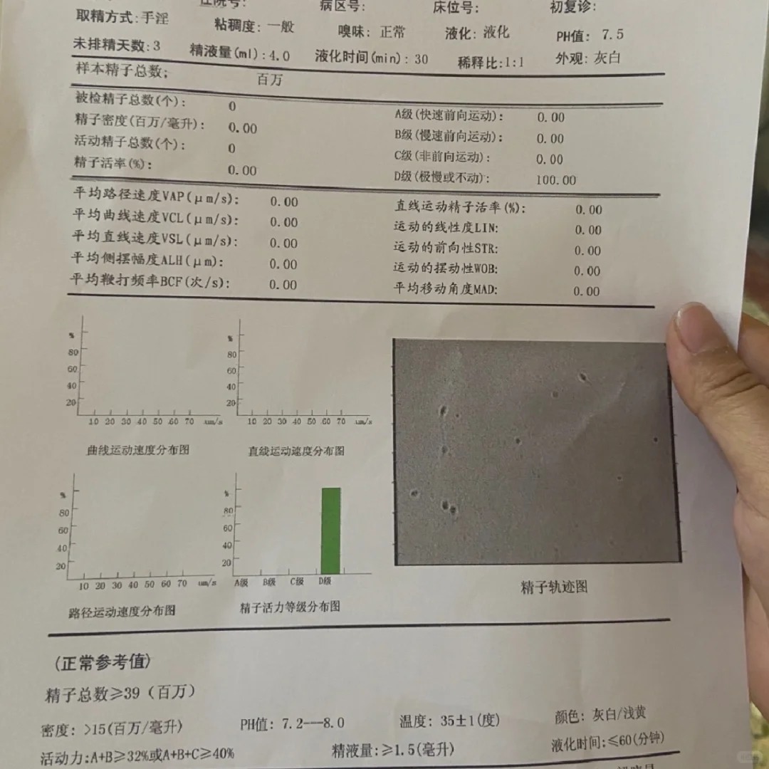 精子太少,这和性生活不规律,前列腺炎,睾丸炎等精液检查男科化验单